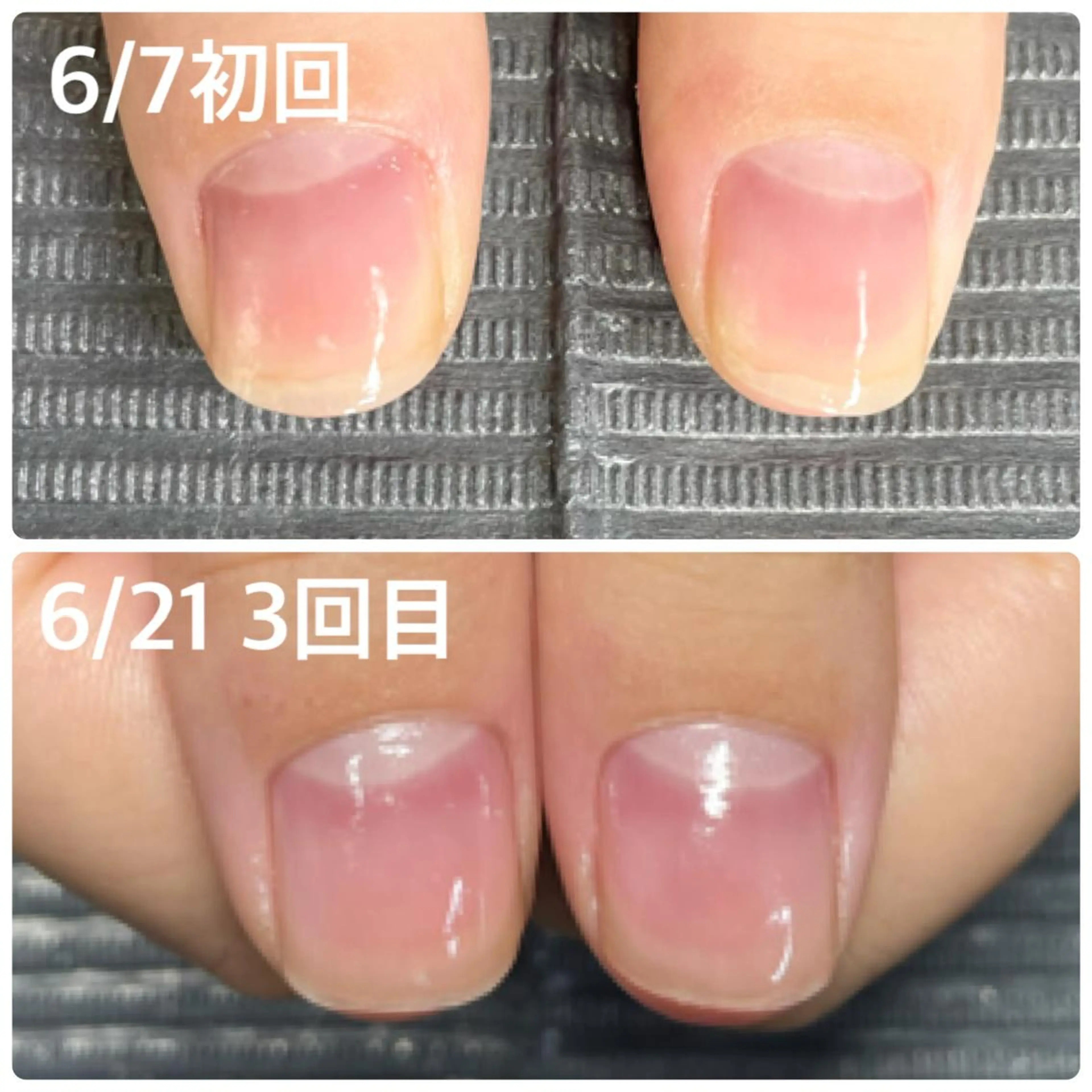 ネイル 奥園 良恵のネイルデザイン