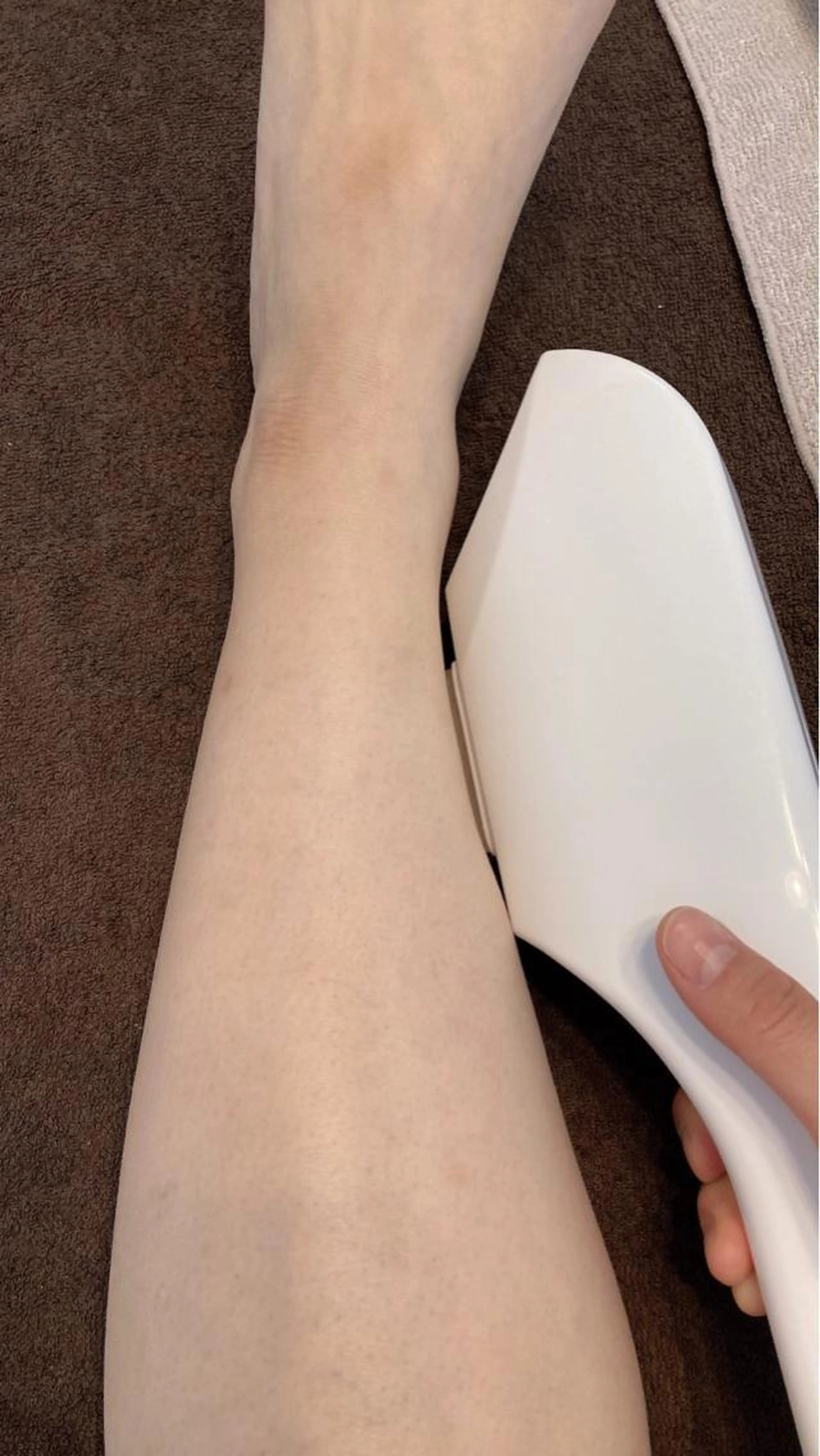 メンズヒゲ脱毛&うであしワキ脱毛の写真