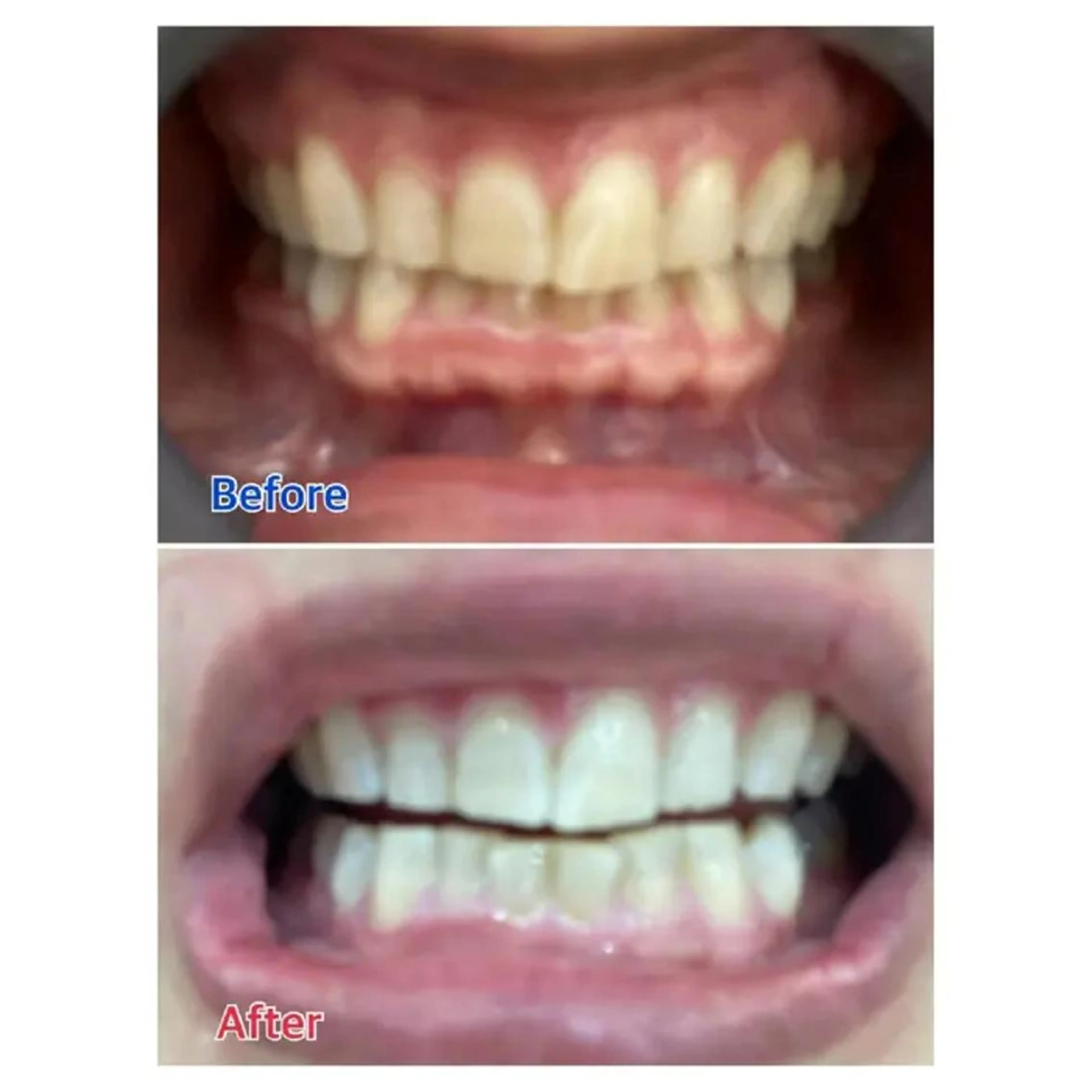 M渋谷 ホワイトニングのエステ・リラクイメージ