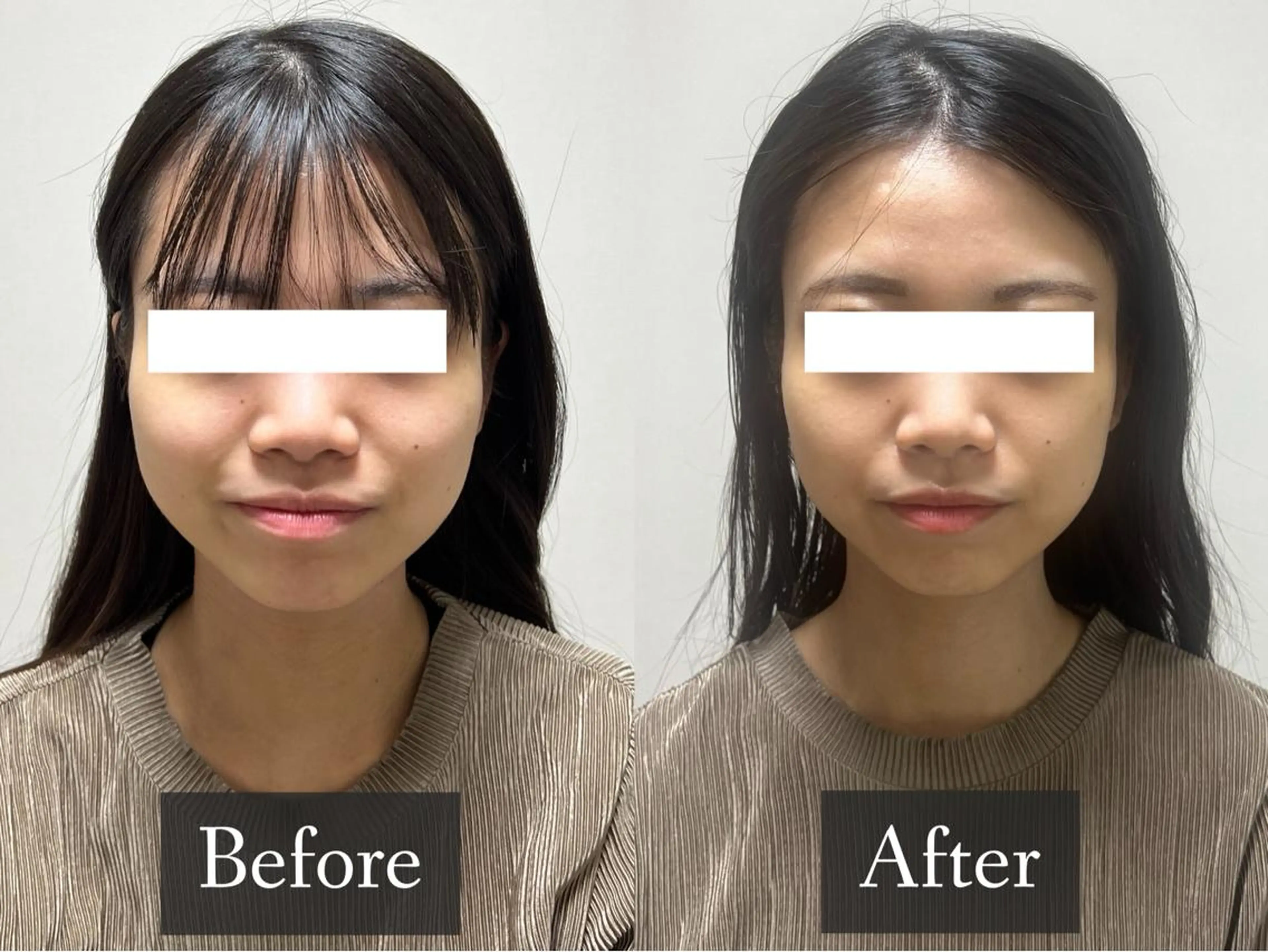 脱毛専門サロン BELFINE恵比寿のエステ・リラクイメージ