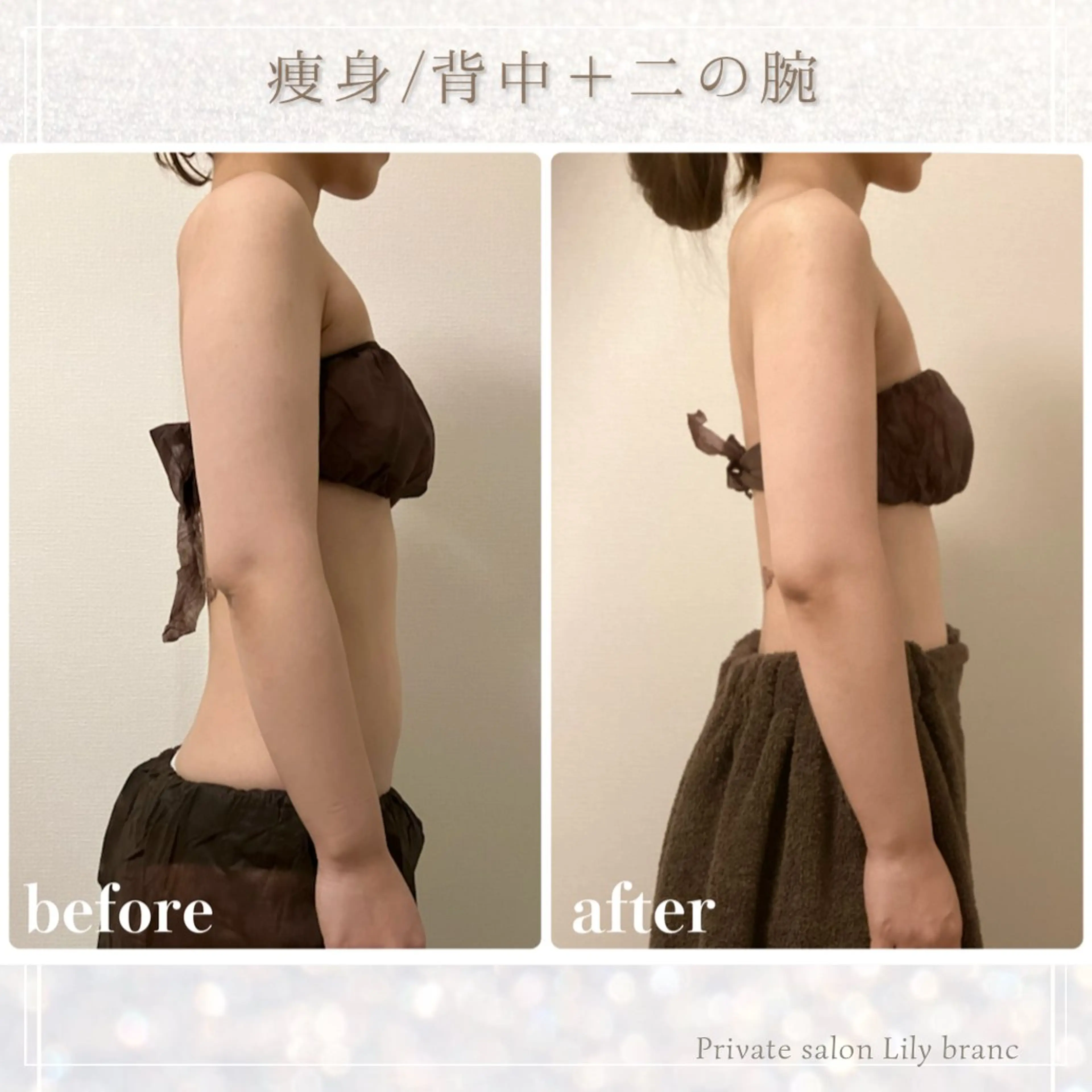 エステ Lily branc 痩身/小顔/肌質改善のエステ・リラクイメージ