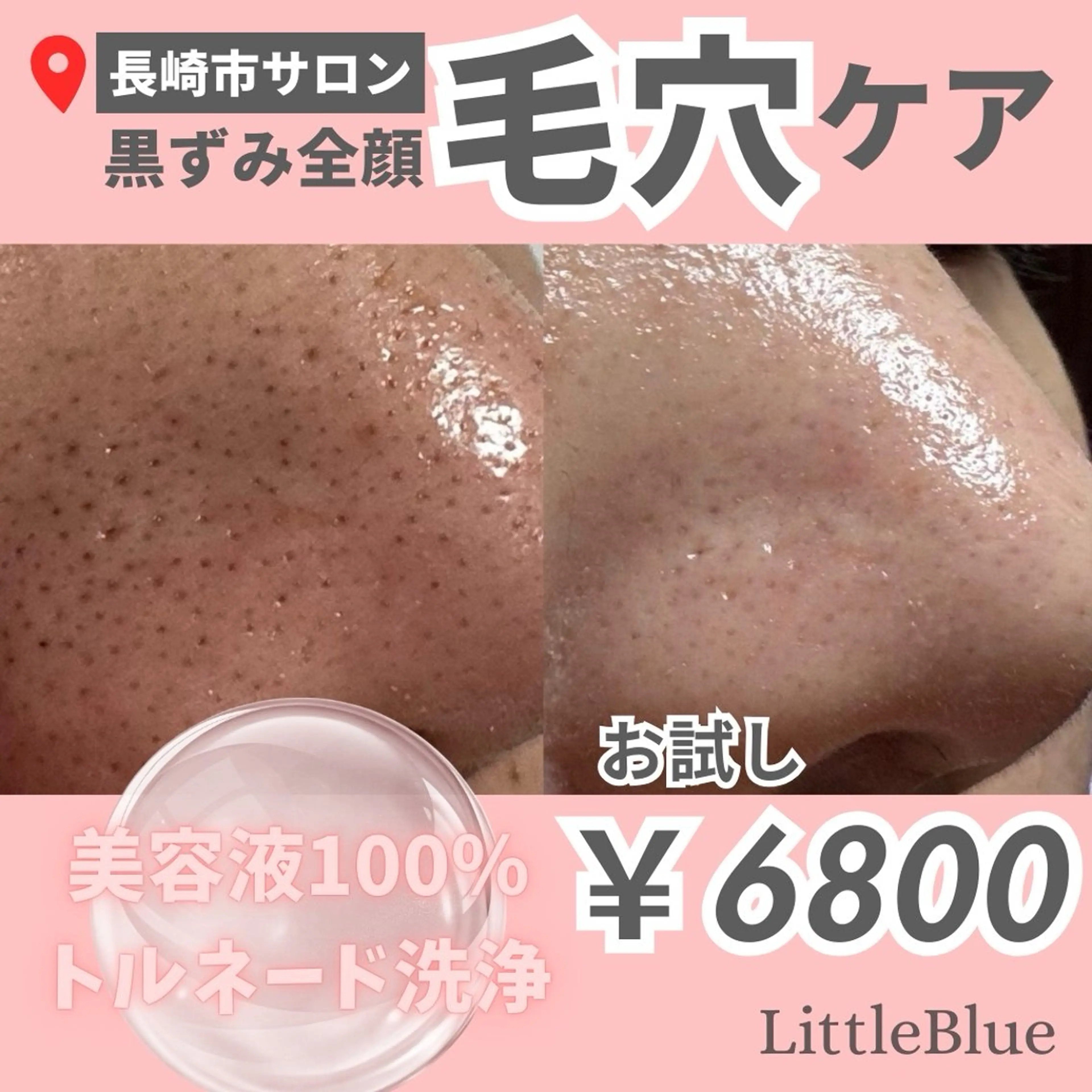 エステ 韓国美容専門店 LittleBlueのエステ・リラクイメージ
