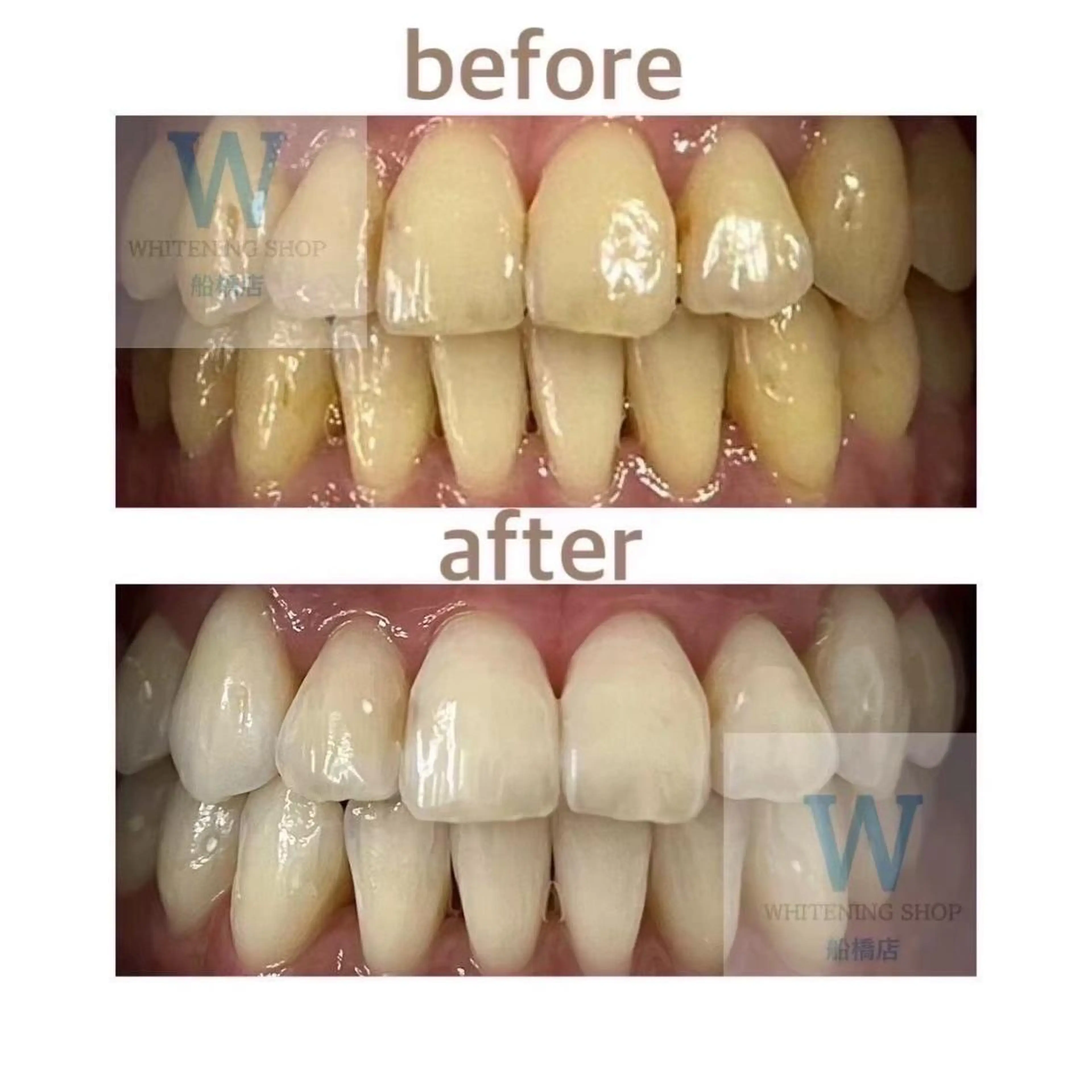 ホワイトニング ショップ船橋店🦷のエステ・リラクイメージ