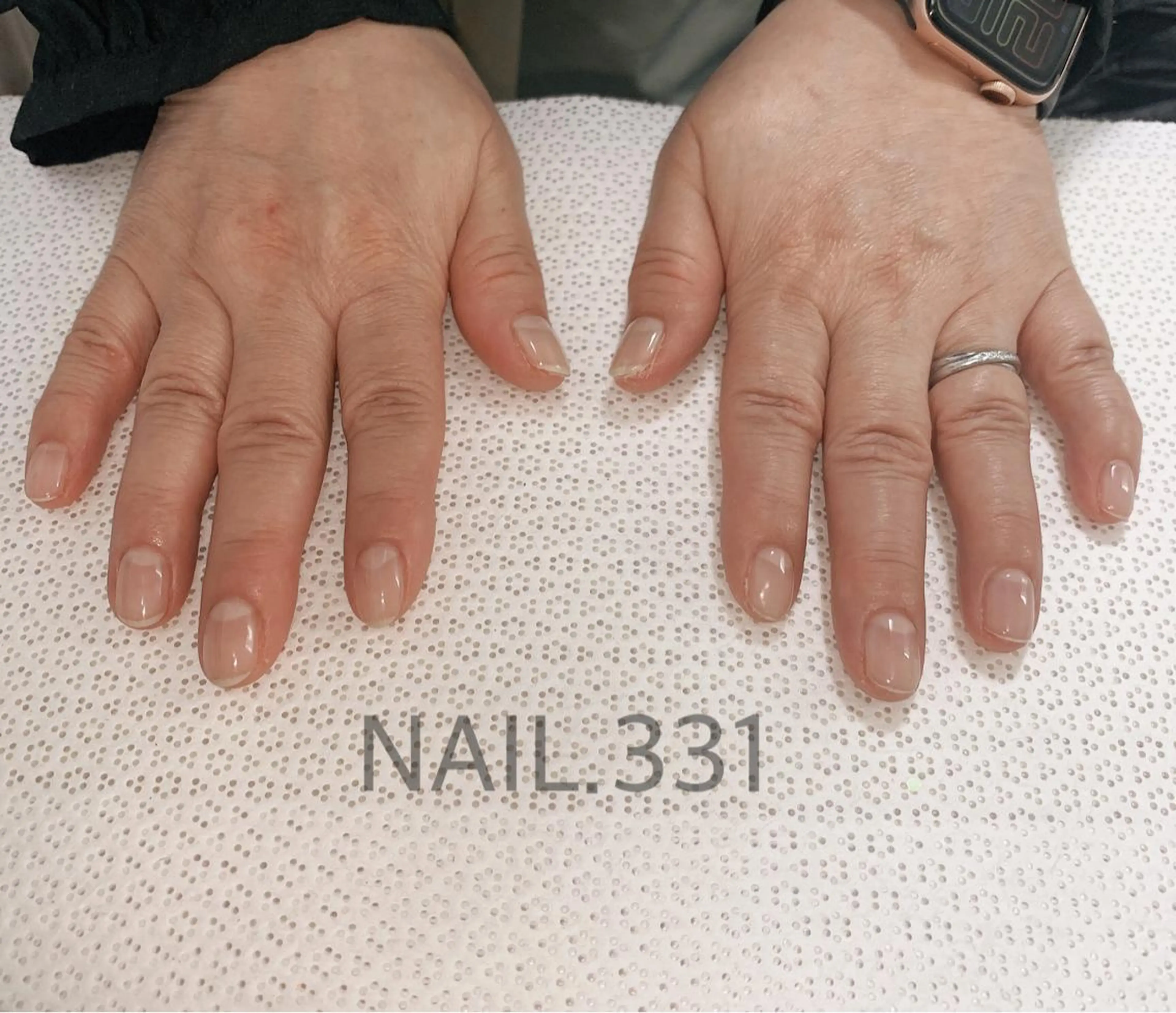 ネイル ハンドネイル Nail 331のネイルデザイン