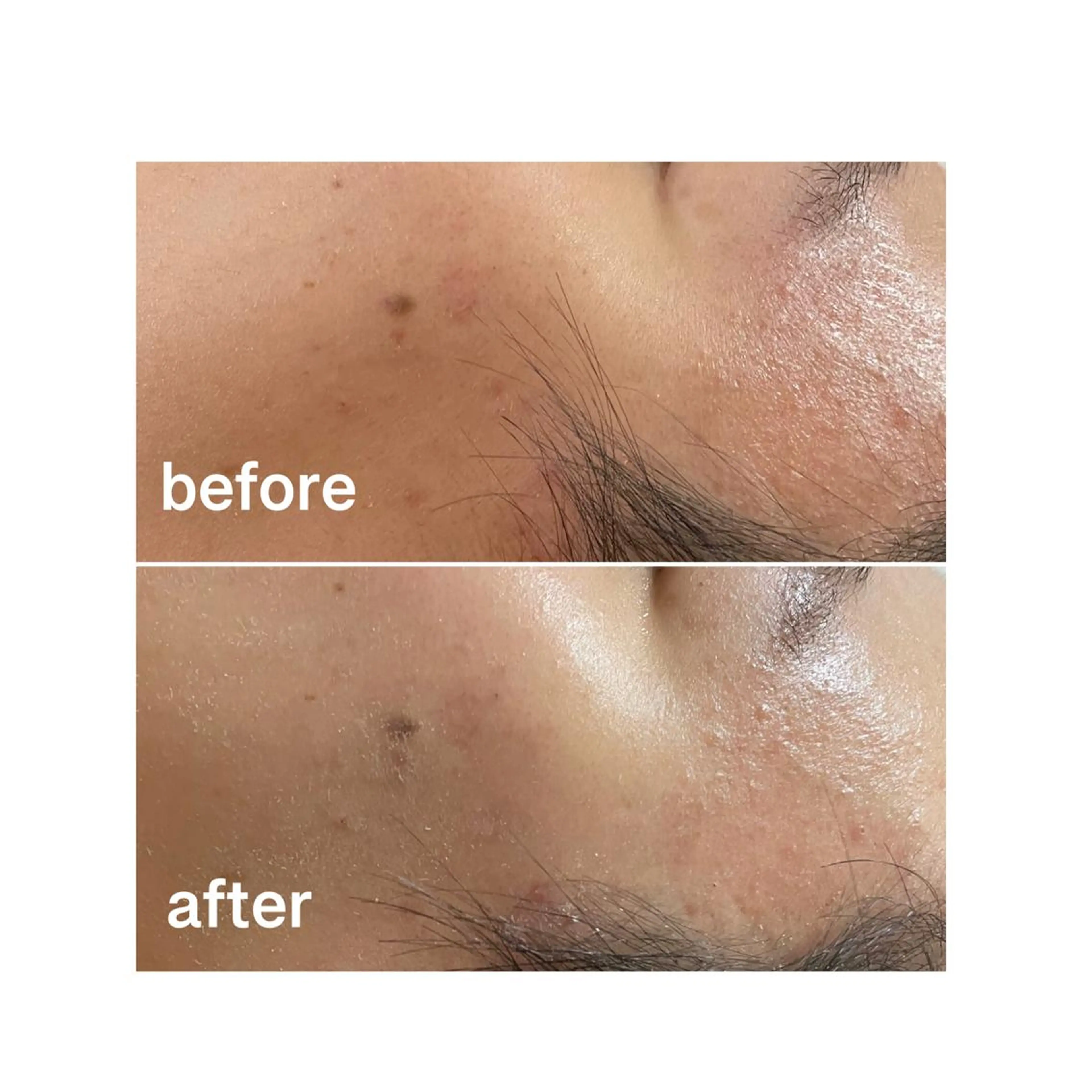 その他 アロマ•ピーリング SalonYokoのその他イメージ