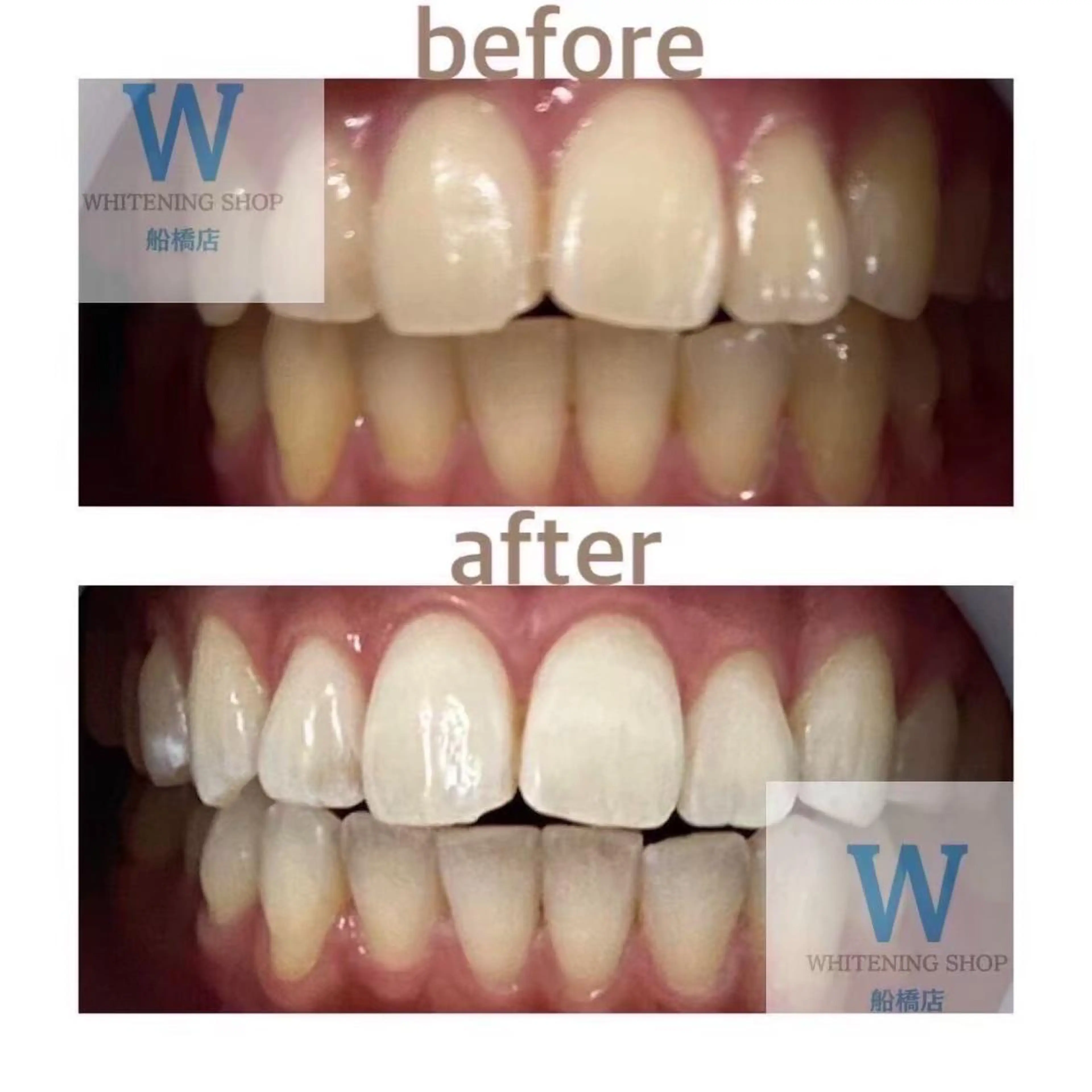 ホワイトニング ショップ船橋２号店のエステ・リラクイメージ