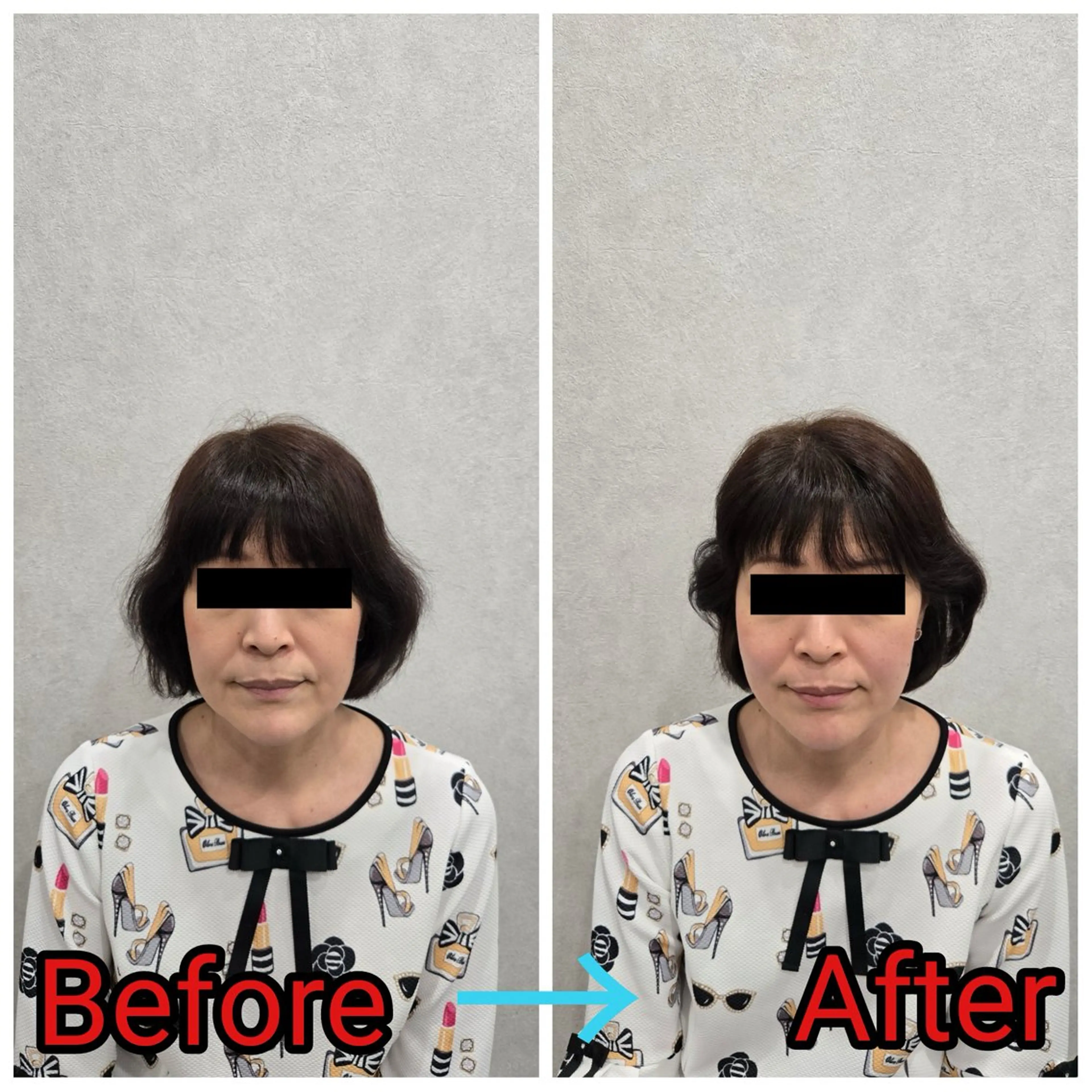 エステ リラク 小顔矯正・美容鍼 FLOW鍼灸整体院のエステ・リラクイメージ