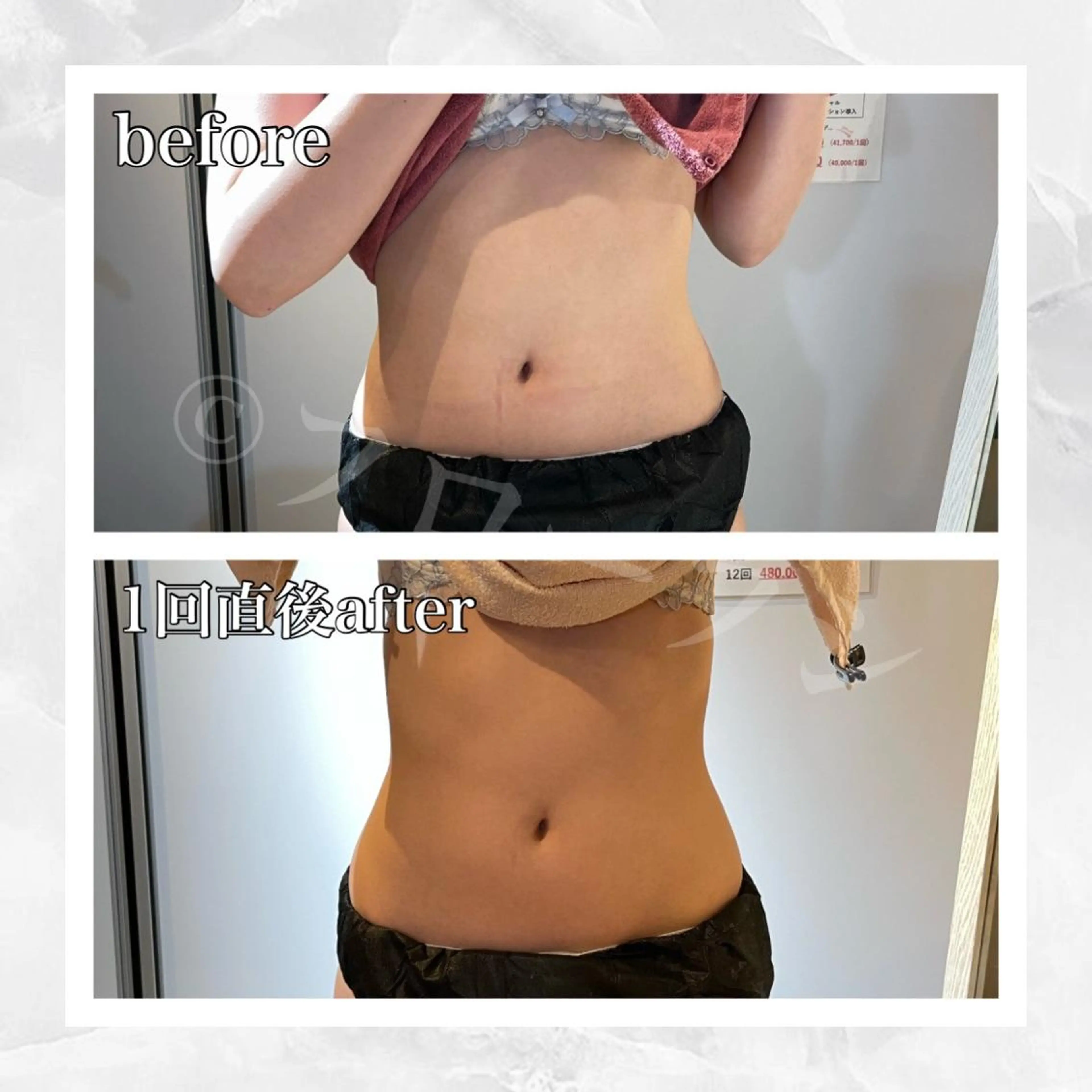 エステ リラク 部分痩せ♥️小顔専門 MIKUのエステ・リラクイメージ