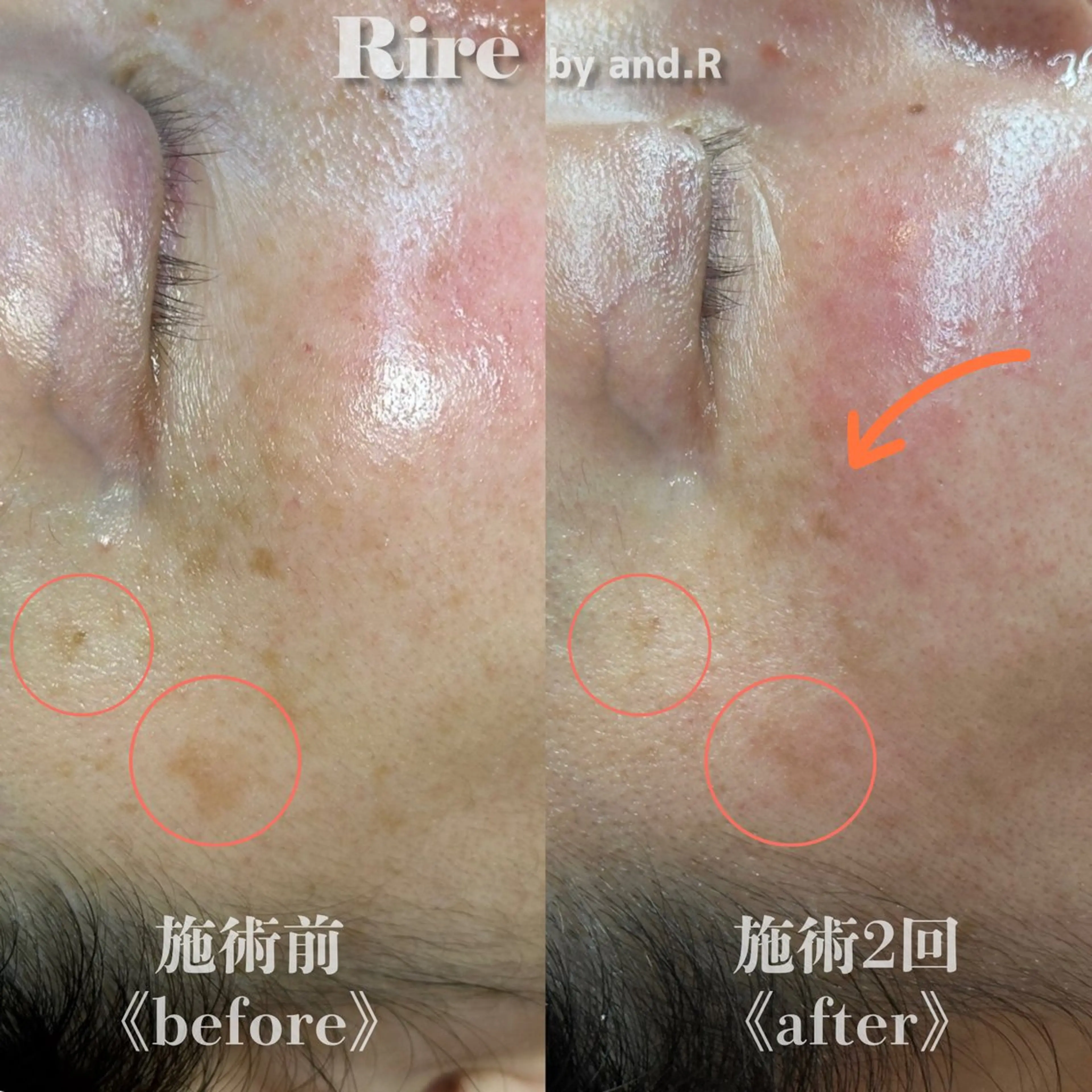 実方 梨々花のエステ・リラクイメージ