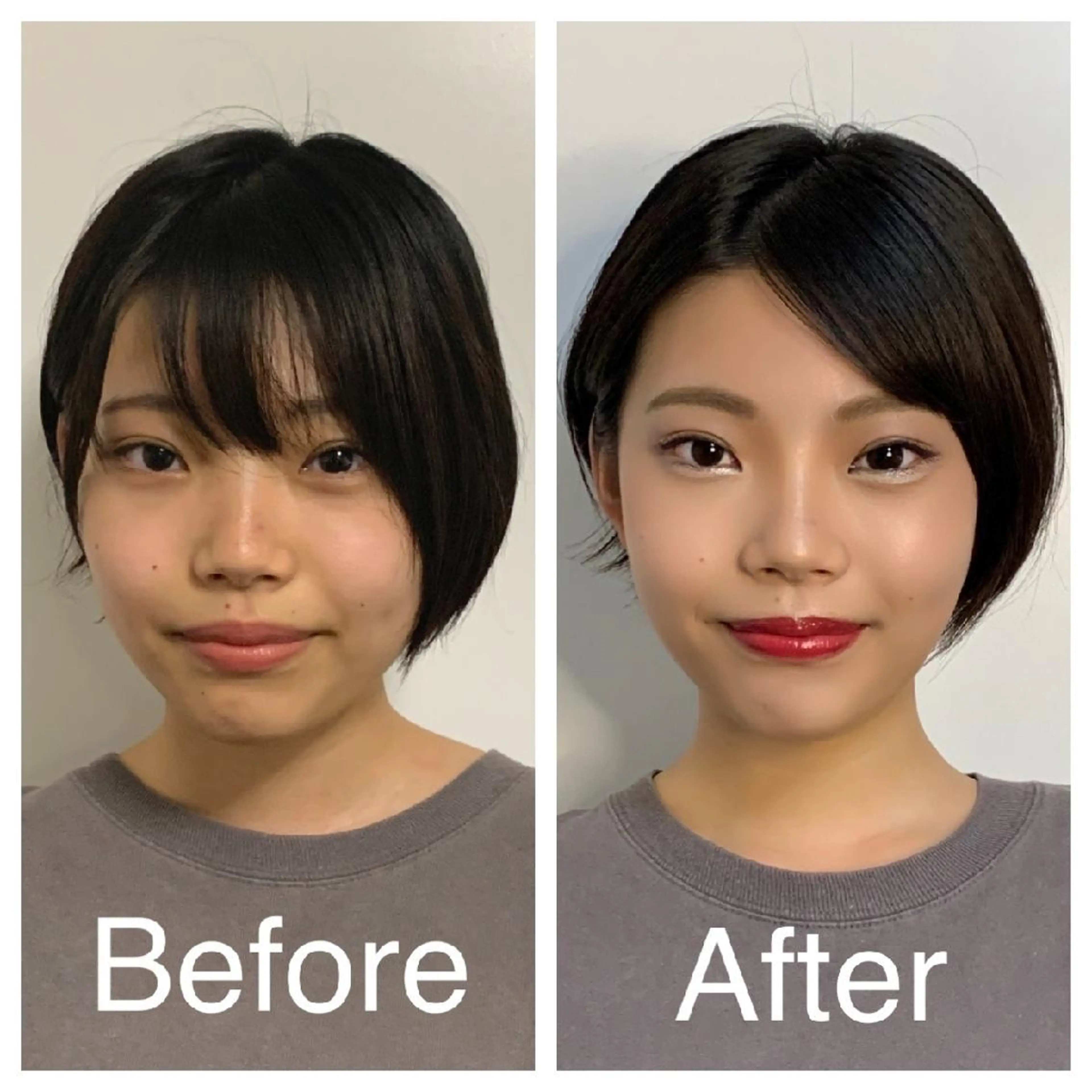 医療提携Ruby小顔 ハーブピーリングのその他イメージ