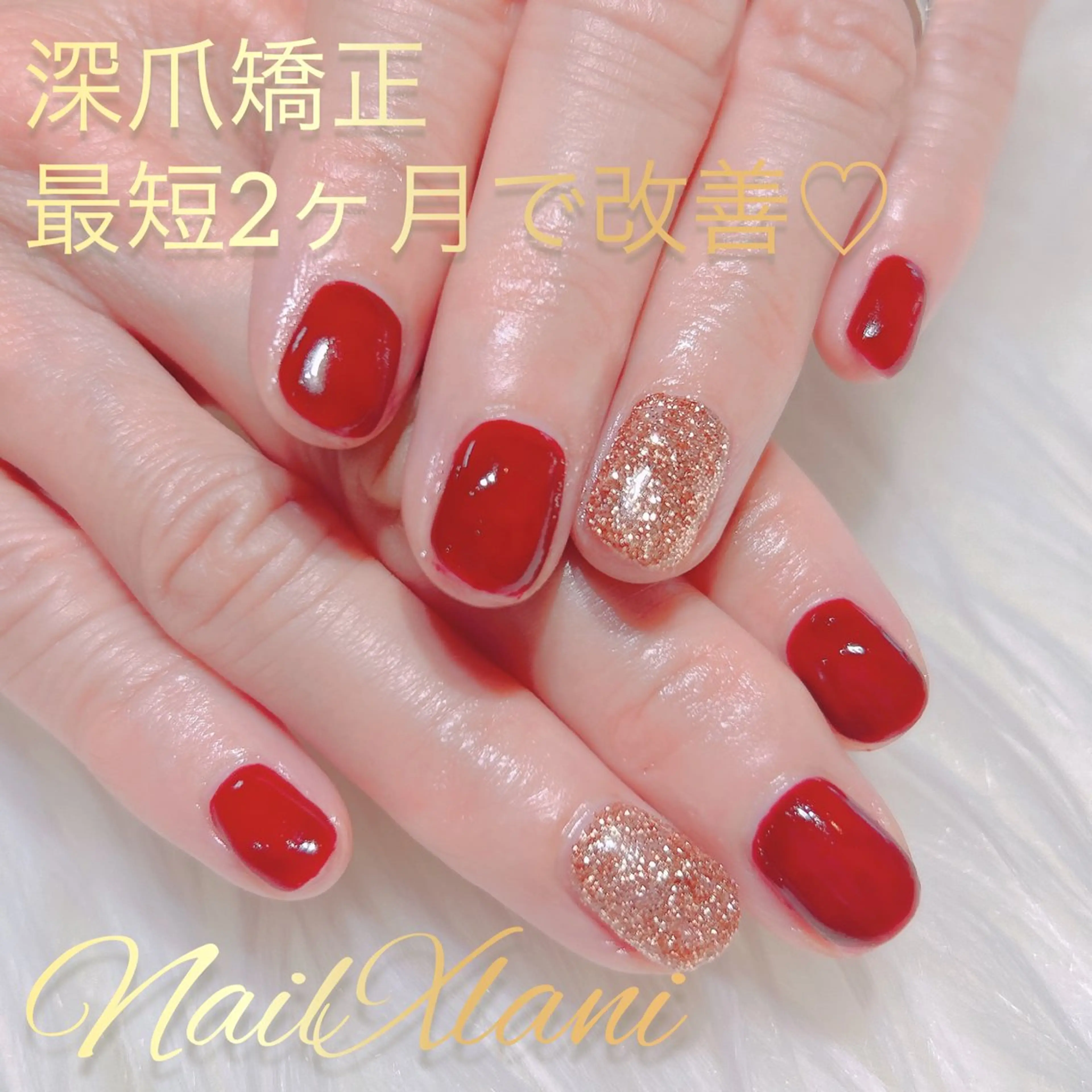 ネイル フットネイル ジェルネイル マグネットネイル パラジェル Nail×Lani 深爪矯正対応◎のネイルデザイン