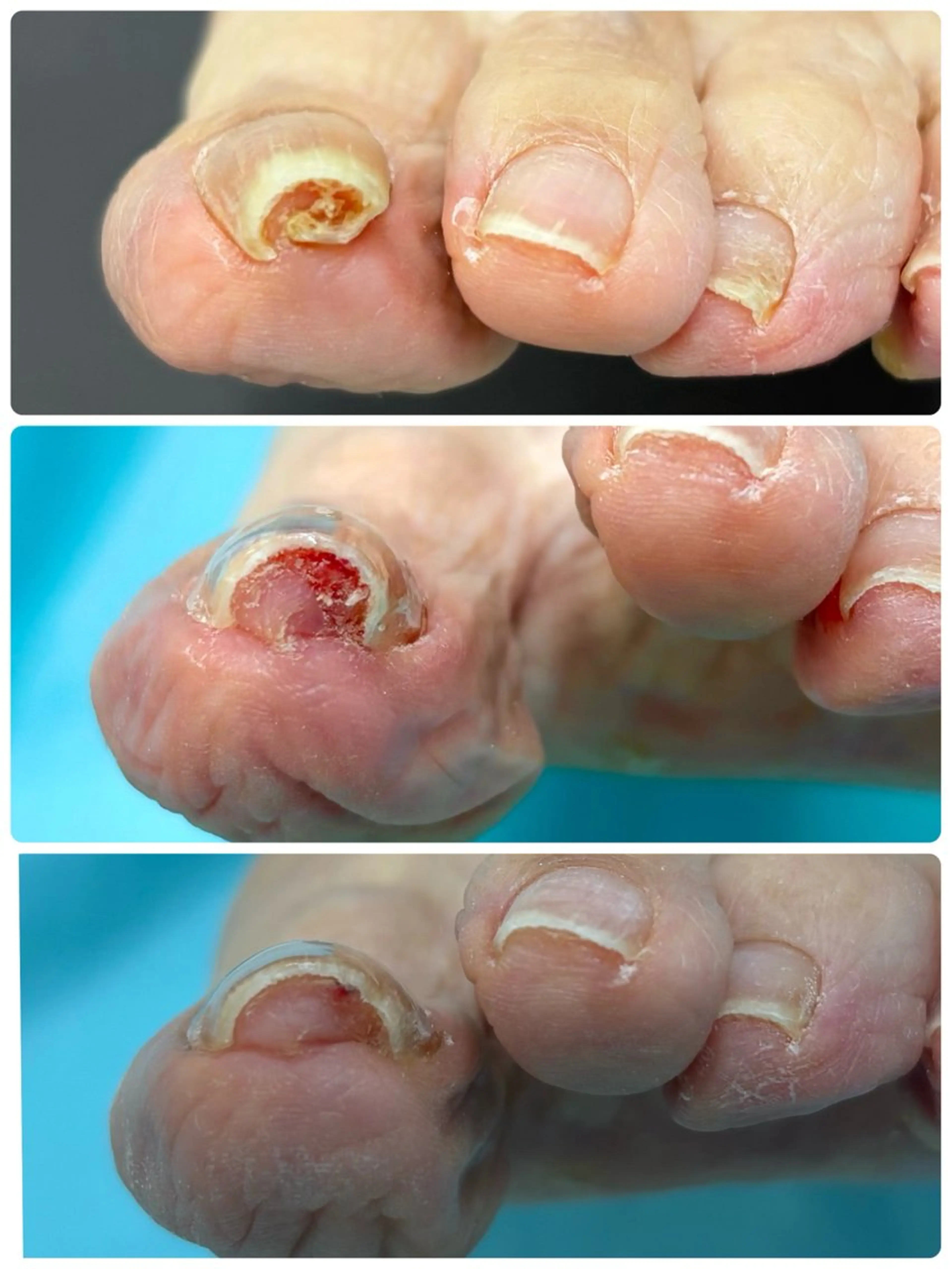 ネイル イルミナ 潤のエステ・リラクイメージ