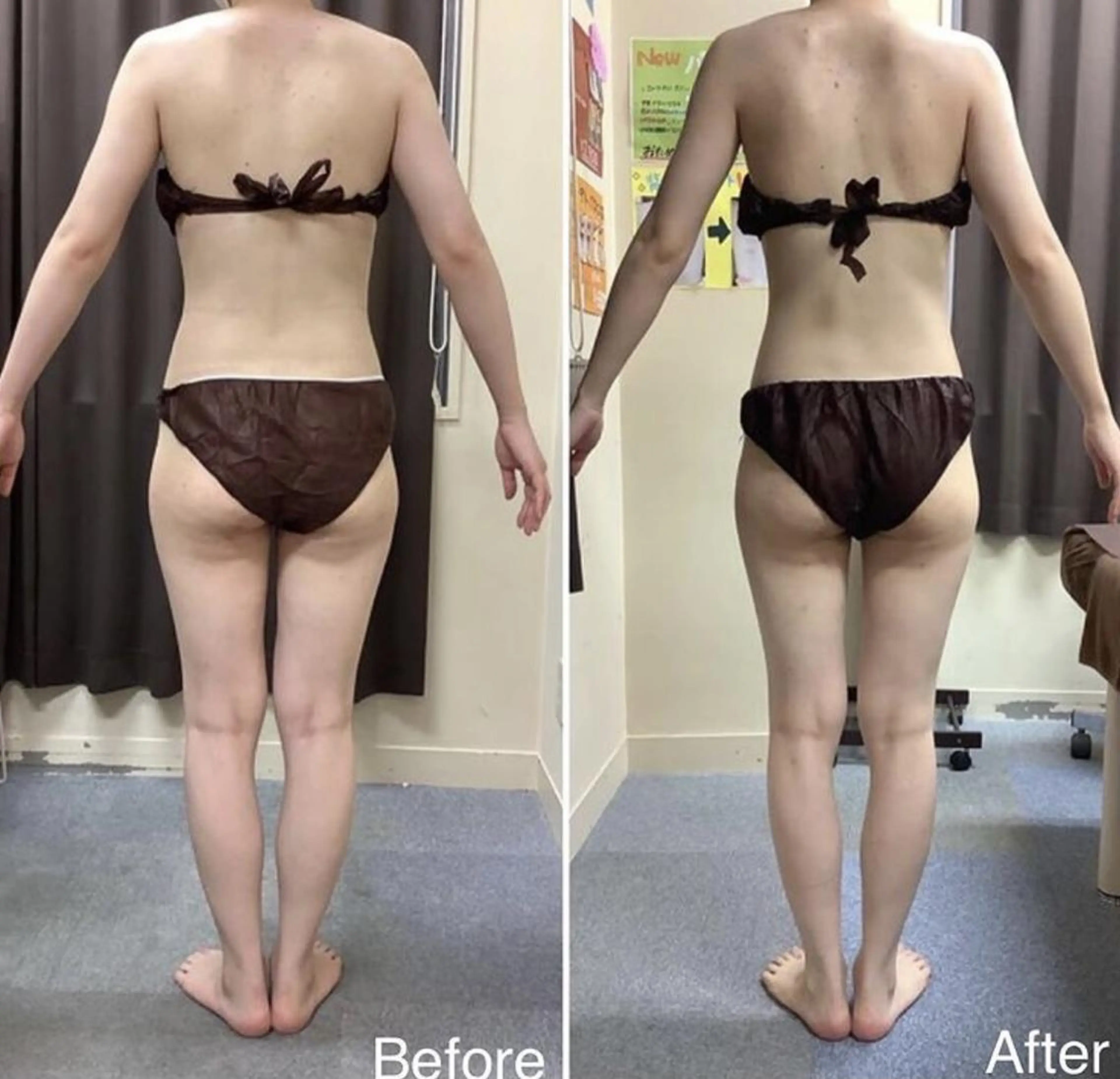 エステ エステティックレイ ビス秋田店　菅野のエステ・リラクイメージ