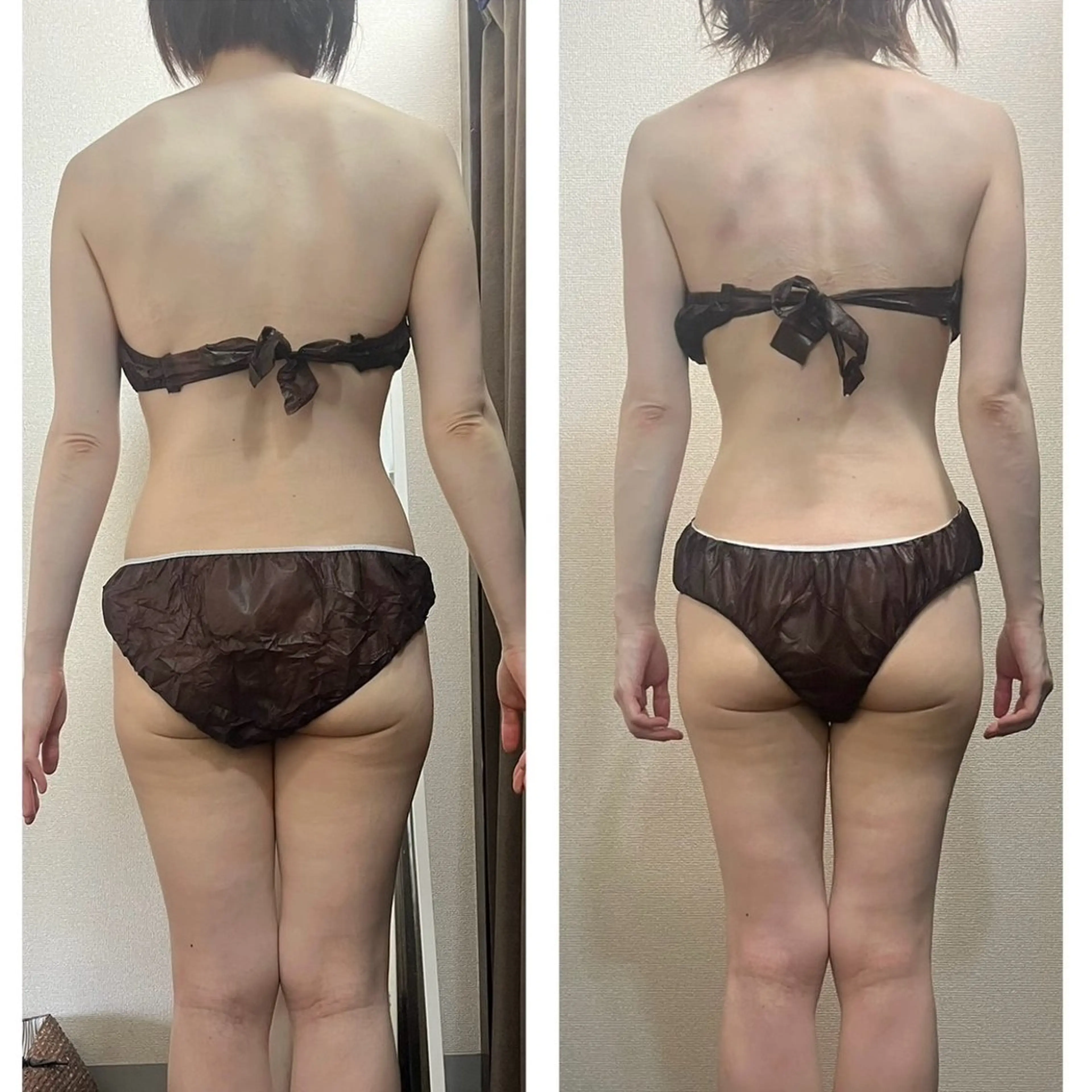 エステ ハイパーナイフ専門店　Salon de COCO所属・Salon de COCOのエステ・リラクイメージ