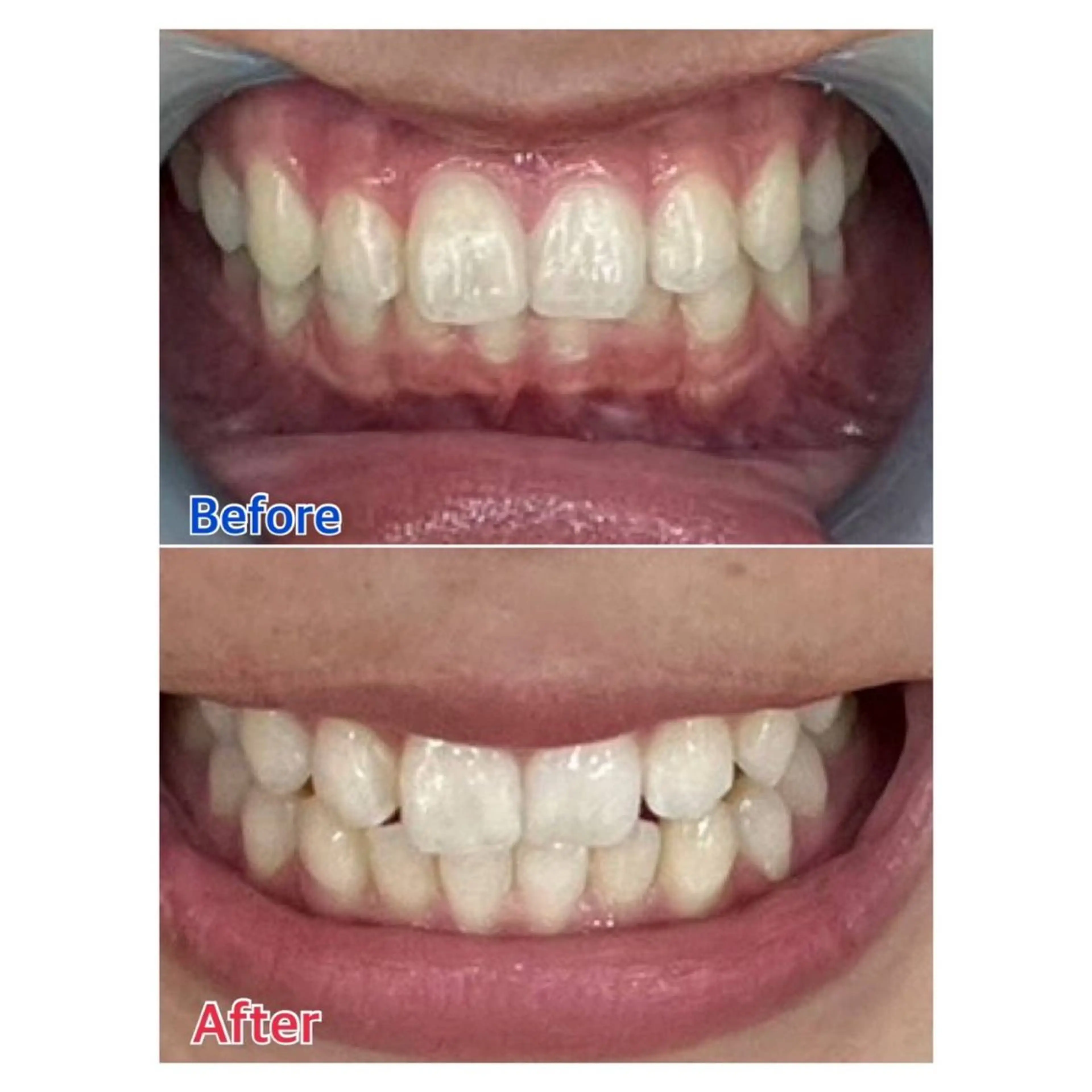 Melty 輝のその他イメージ