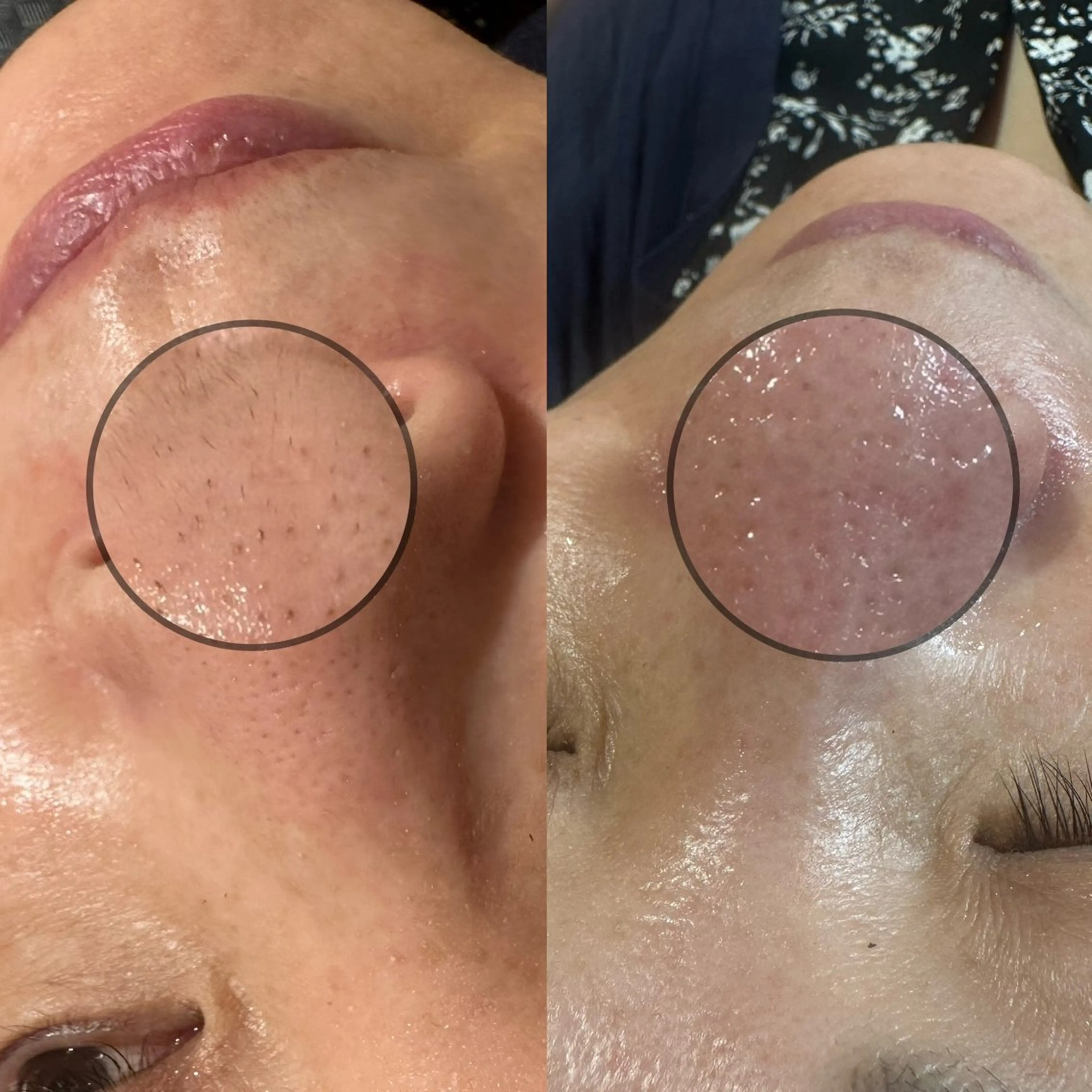 アイラッシュサロン ブラン川越店のマツエク・マツパデザイン