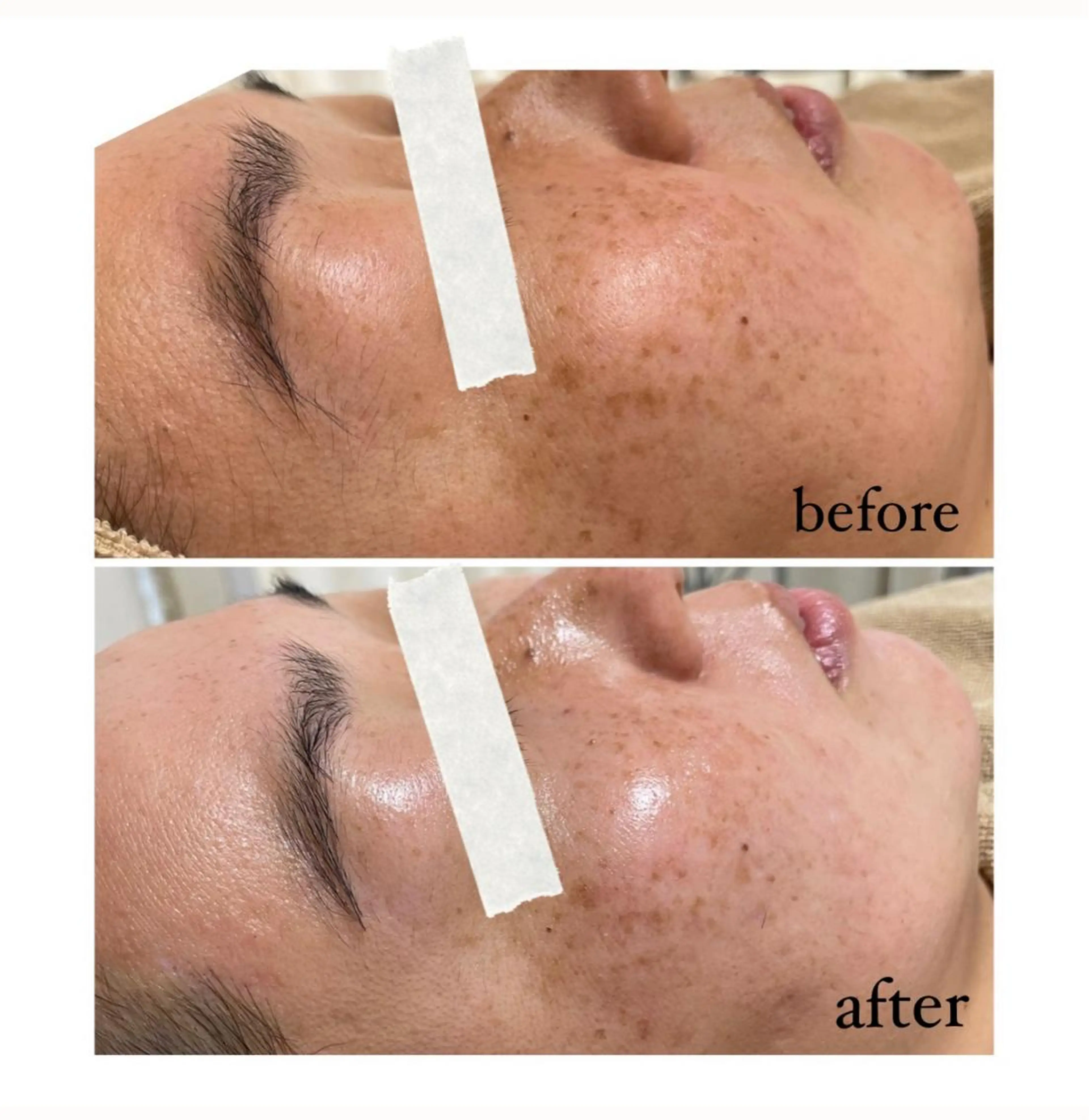 脱毛 エステサロン Mi-mi.iのエステ・リラクイメージ