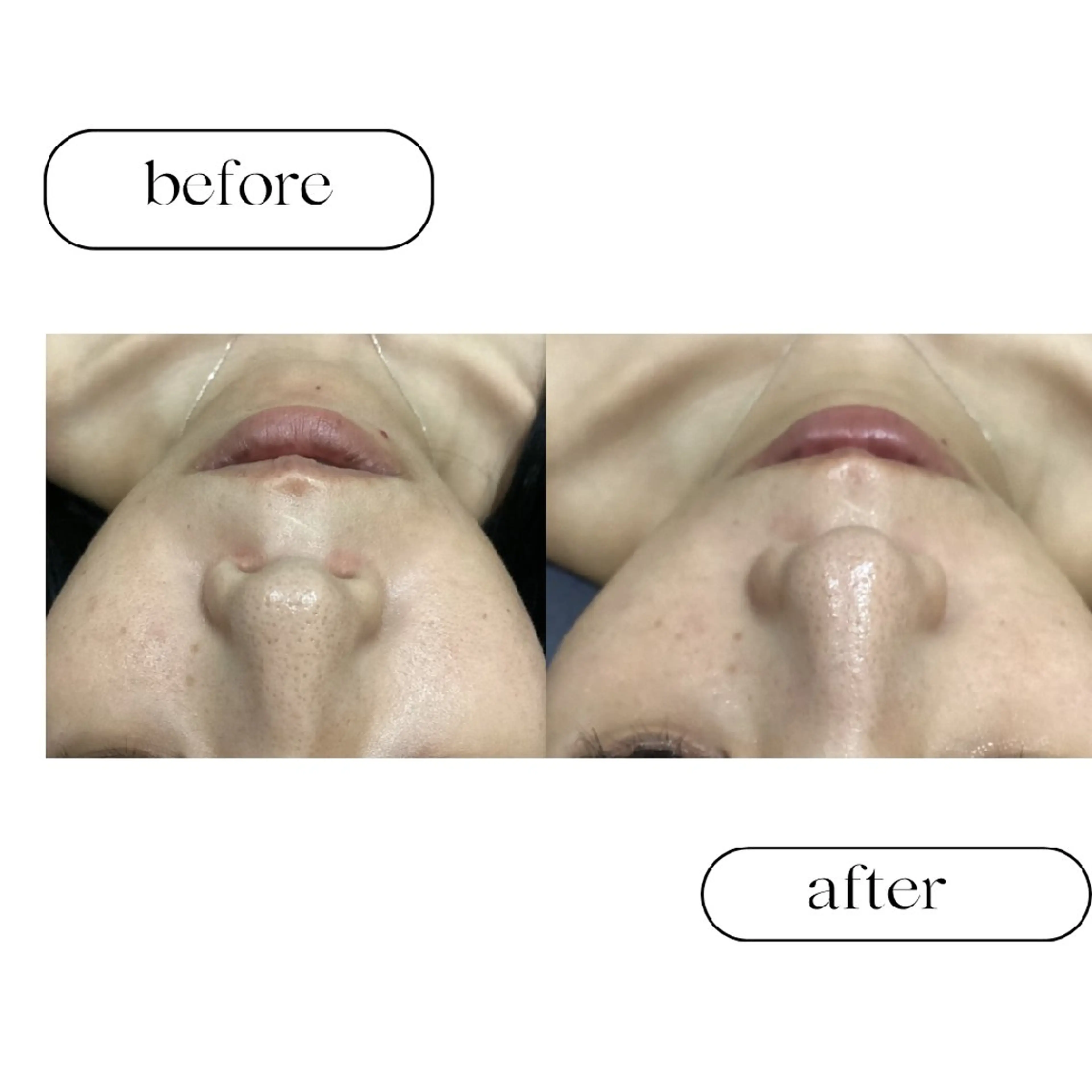 美肌専門サロン RUBONのエステ・リラクイメージ