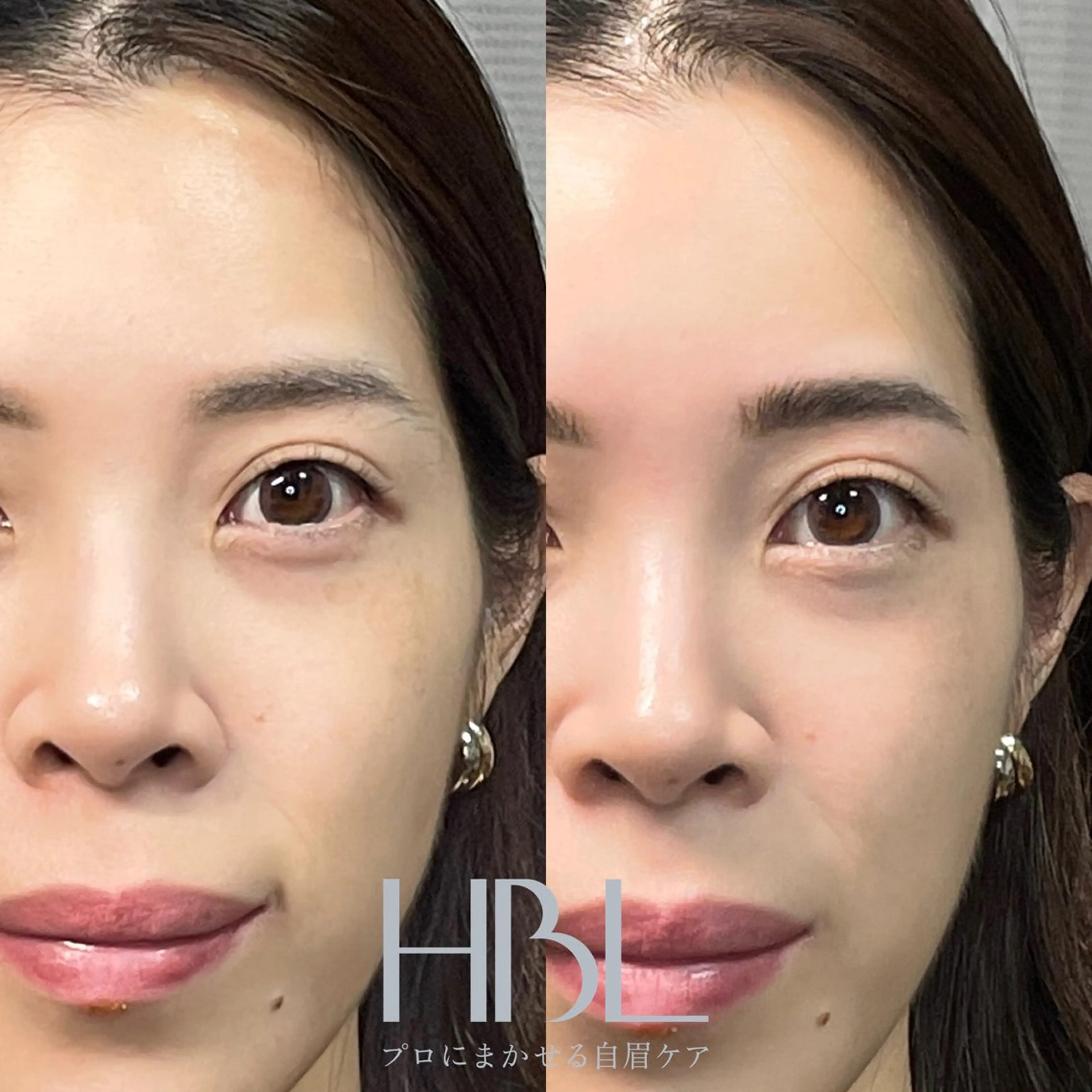 新HBL(ハリウッドブロウリフト)+眉毛トリートメントの写真