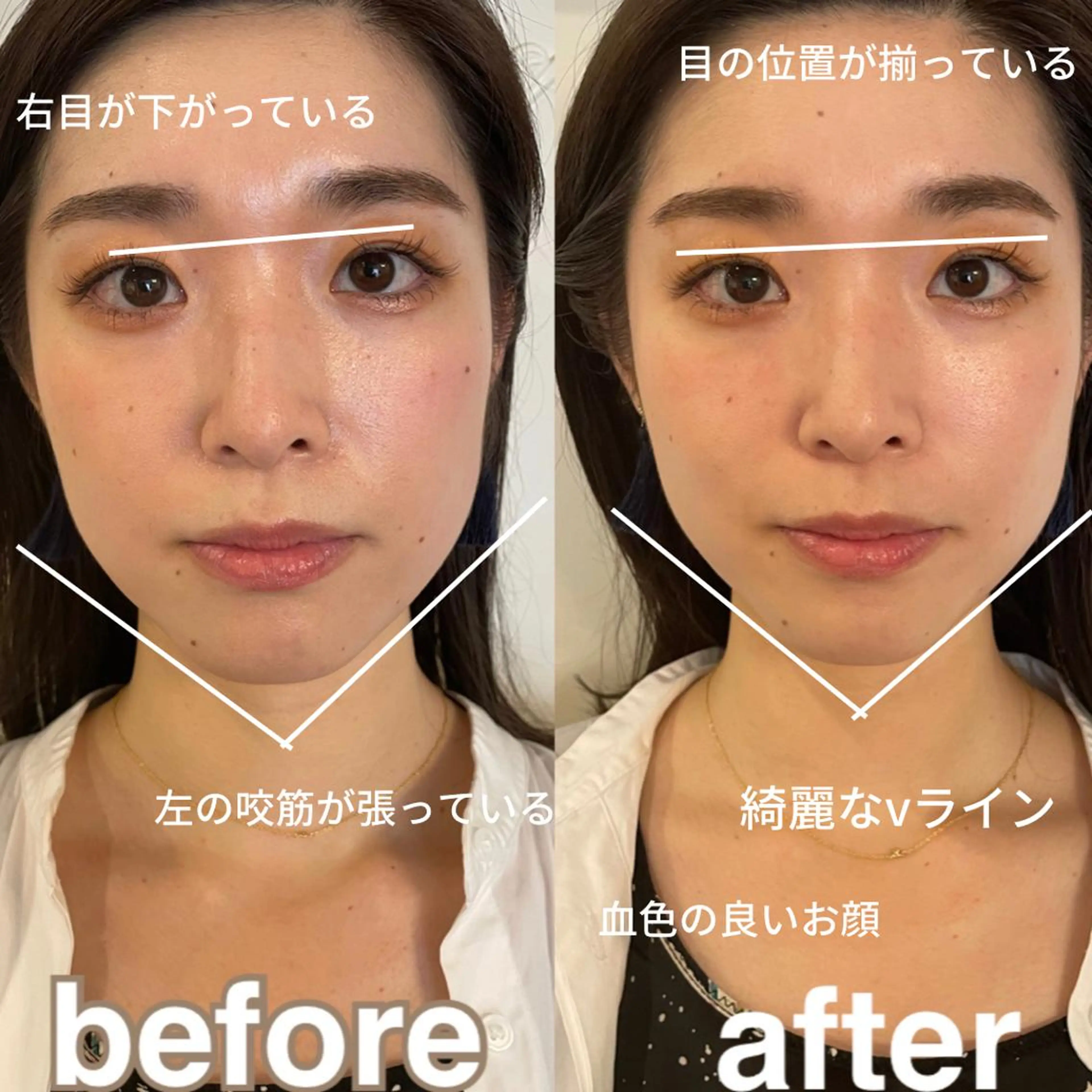 美容鍼灸サロン mahoroba院長のエステ・リラクイメージ