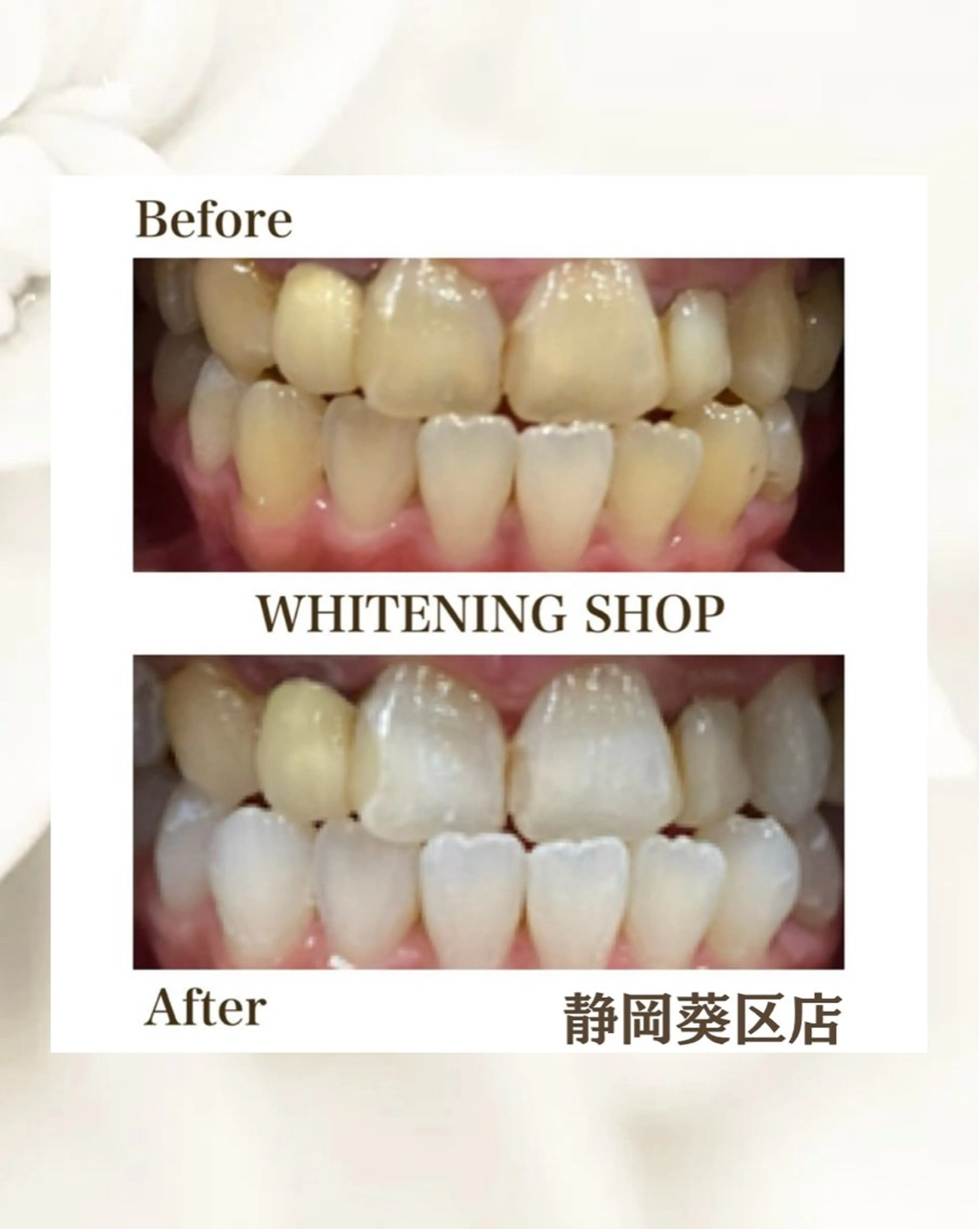 ホワイトニング ショップ葵区静岡駅店のその他イメージ