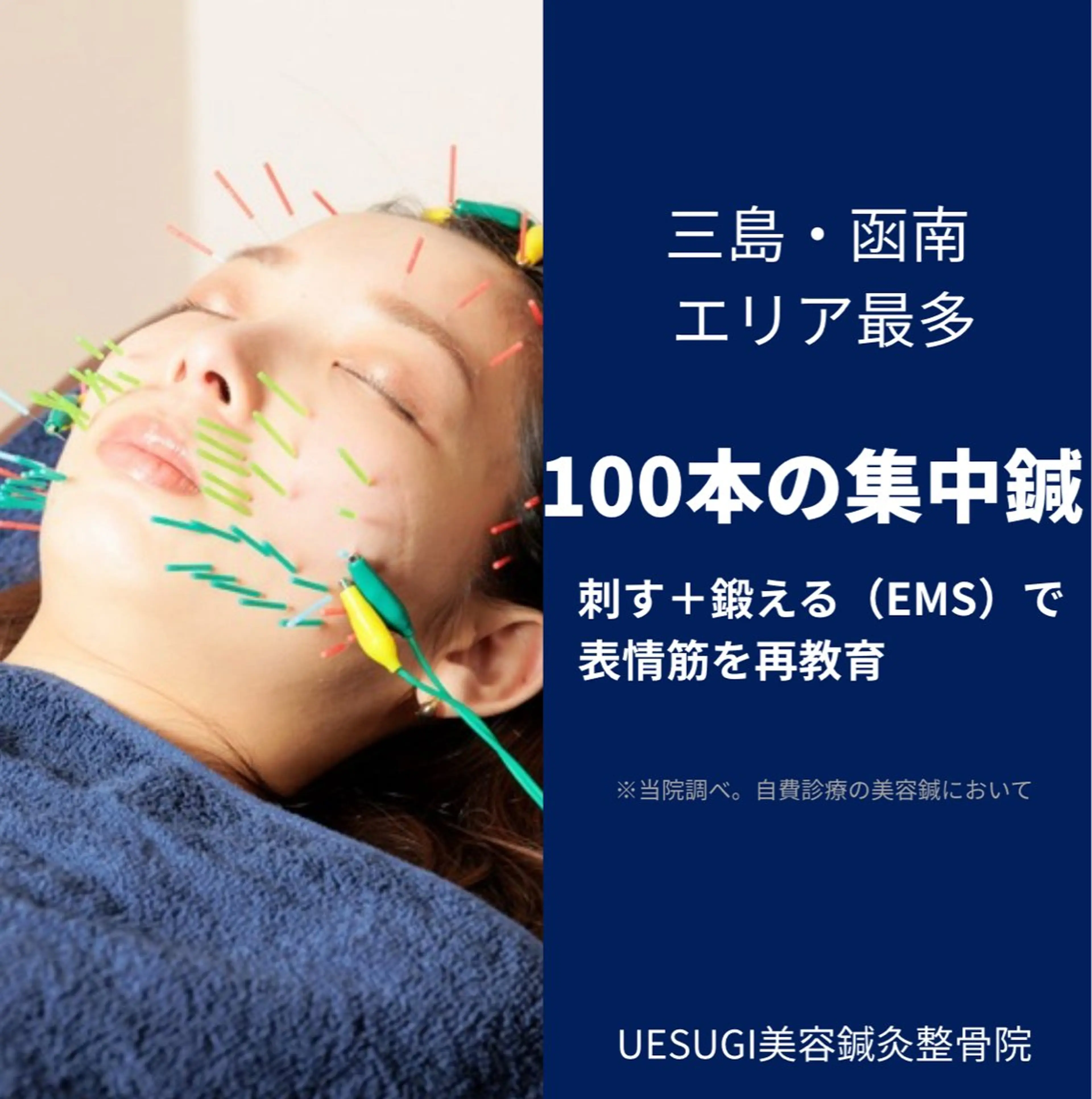 【🉐平日限定🉐】美容鍼(75分)※写真掲載+口コミご協力いただける方限定の写真