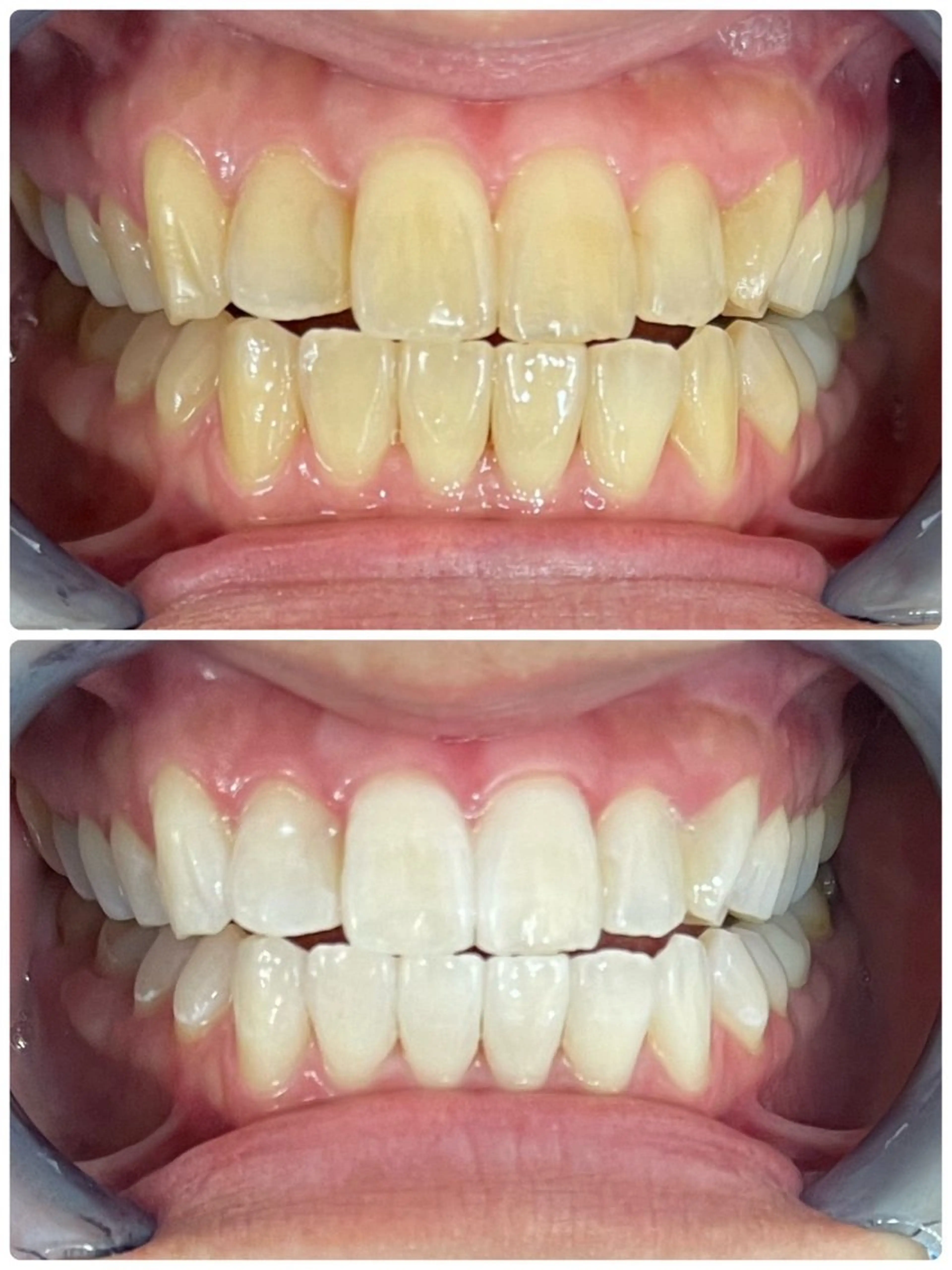 セルフホワイトニング エクシア徳島店マユのその他イメージ