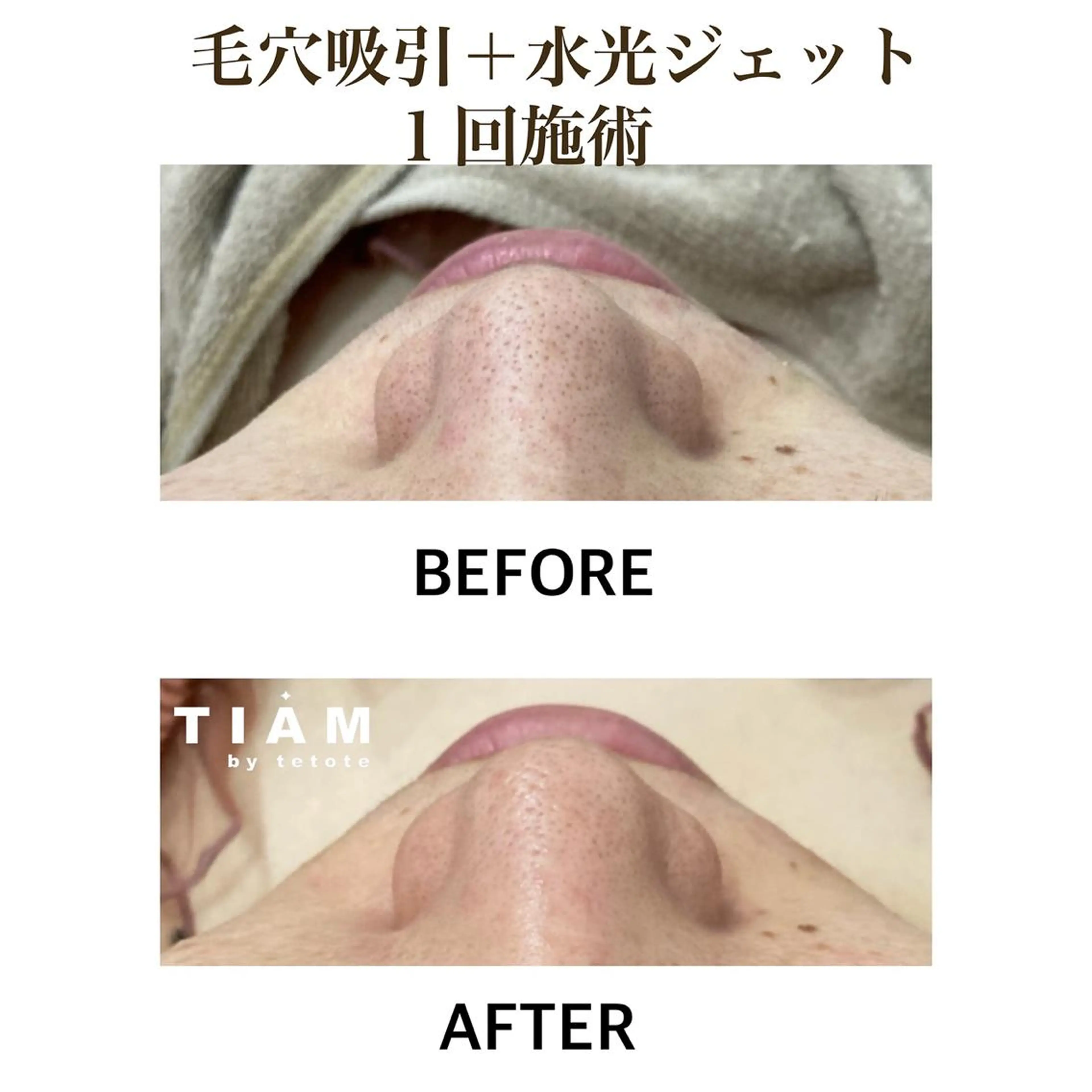 美肌サロンTIAM by tetoteのエステ・リラクイメージ