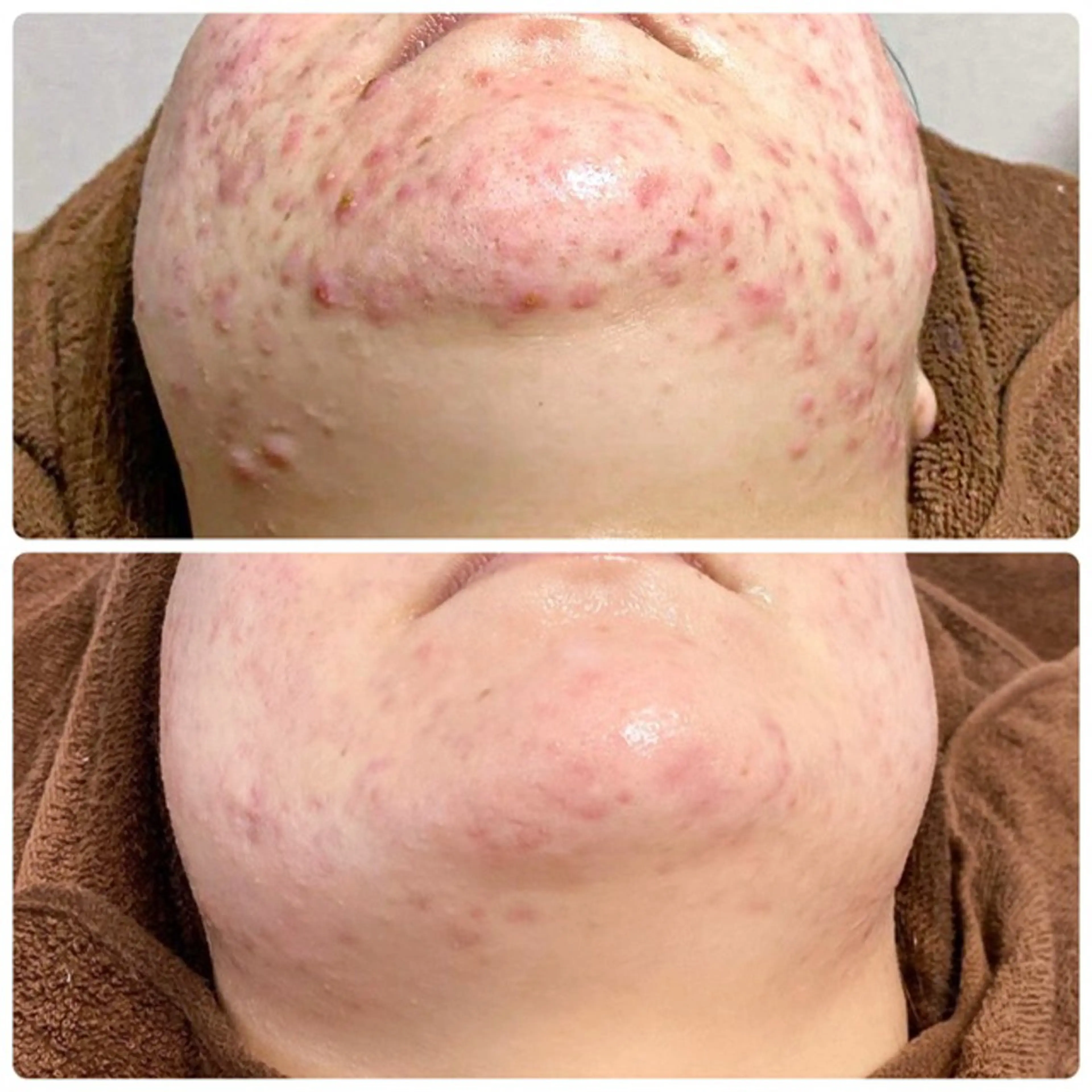 ビューティーホリック 東金店のエステ・リラクイメージ