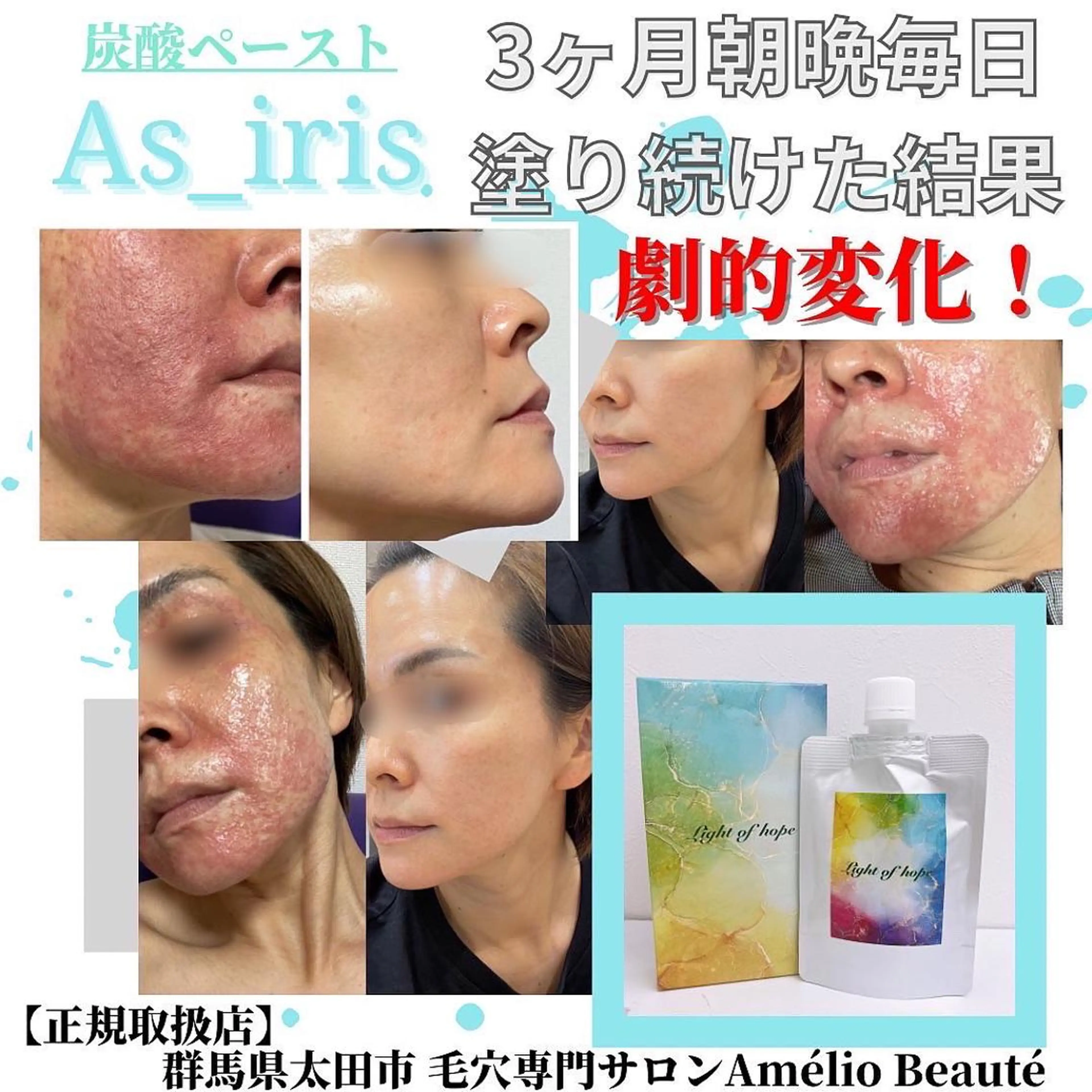 毛穴ケア専門サロン アメリオボーテのその他イメージ