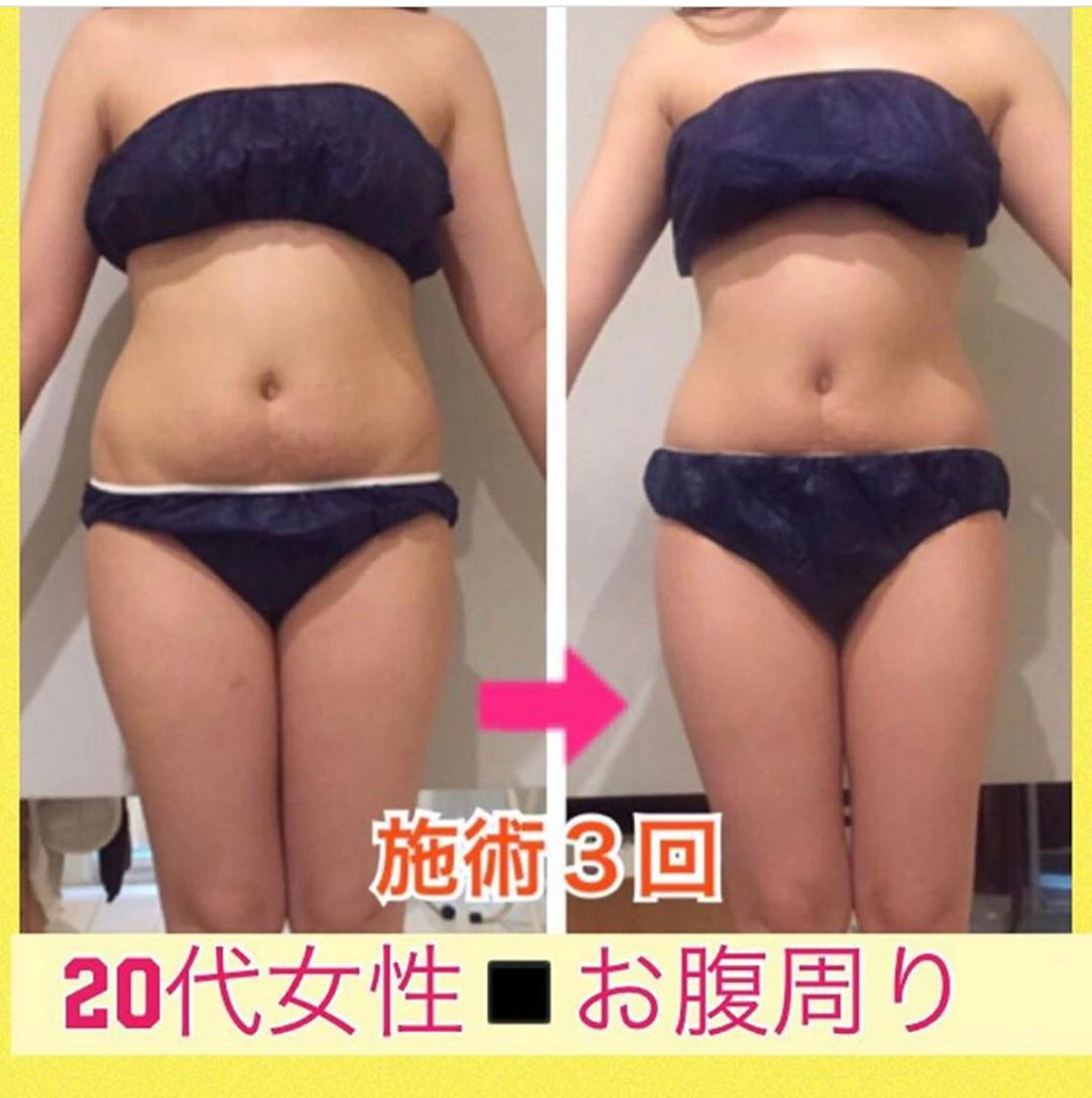 ロング カラー パーマ ヘアアレンジ メンズ キッズ ネイル マツエク・マツパ ‍痩身＆ボディ 結果出し🌟丹野のエステ・リラクイメージ