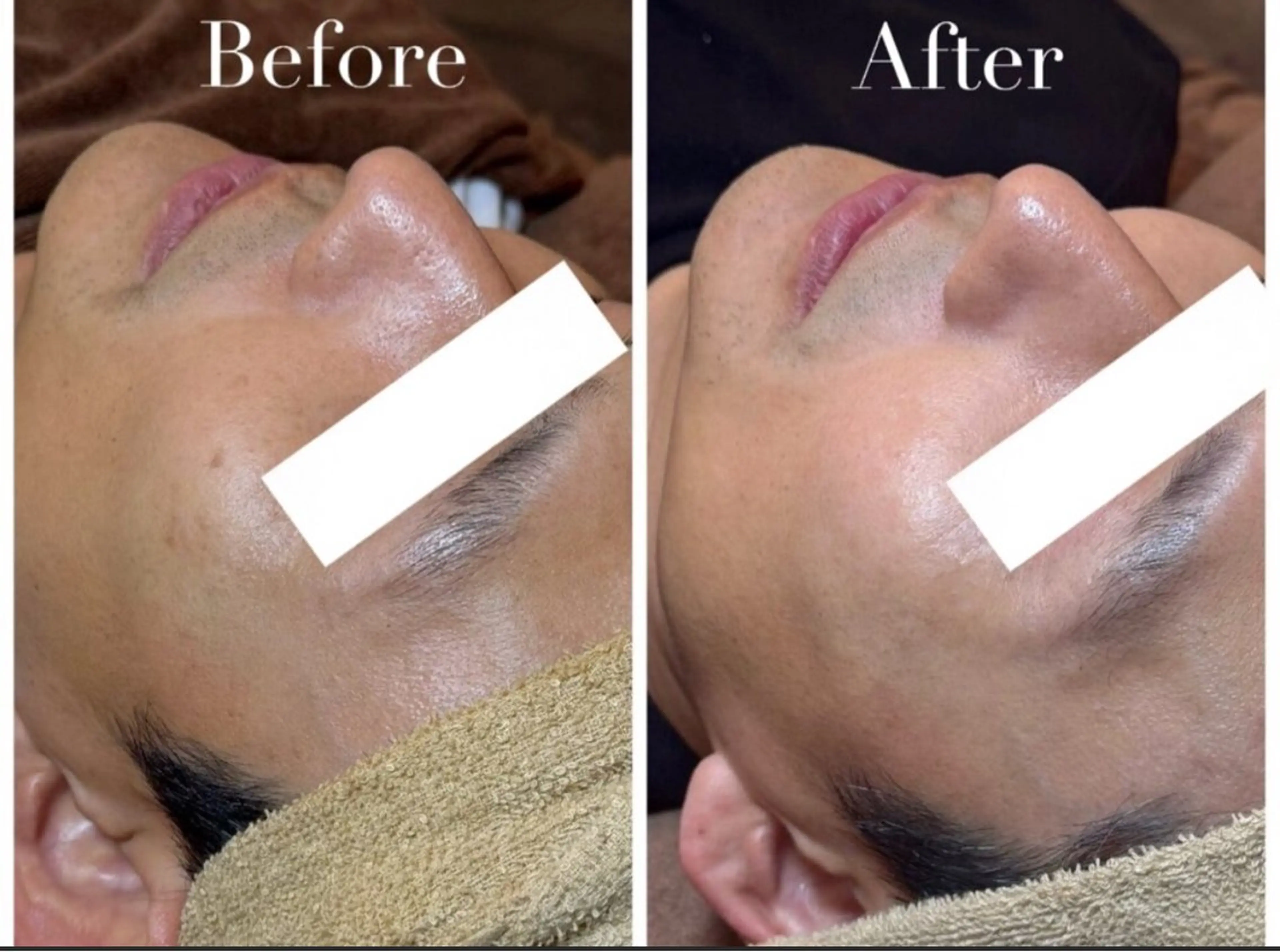 エステ Avenir Brillant所属・松田 紗季のエステ・リラクイメージ