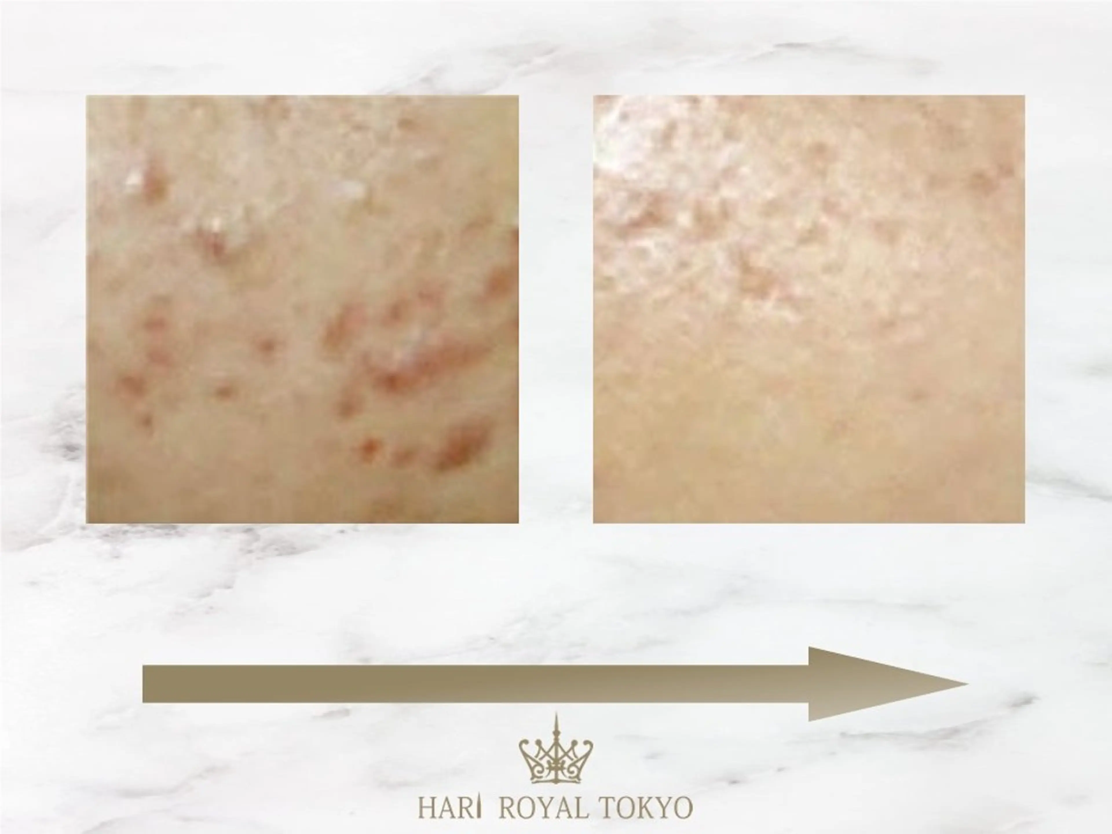 ハリロイヤルトーキョー武蔵小山所属・ニューハーフ鍼灸師 🖤🤍Saya🌹のエステ・リラクイメージ