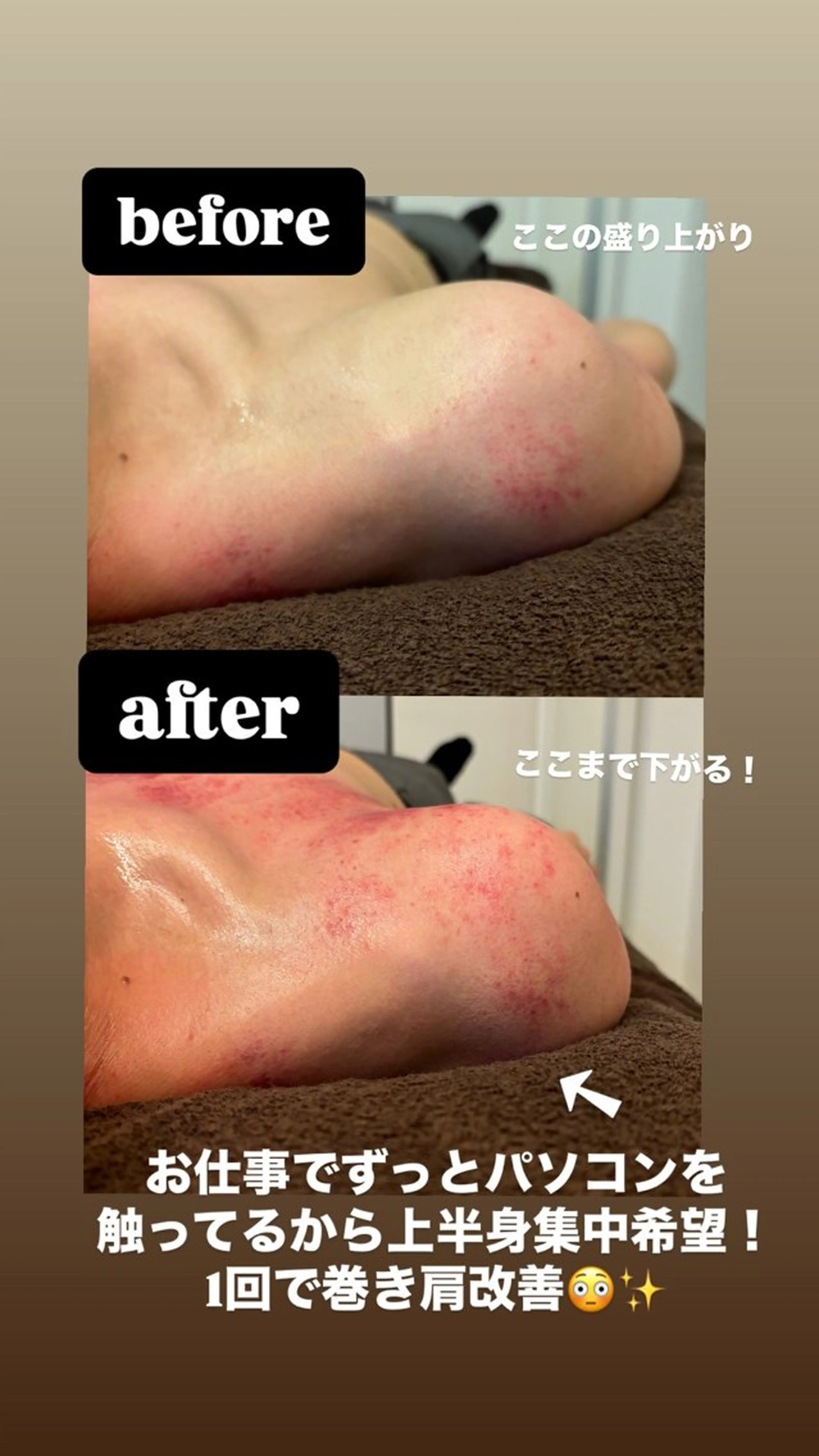 💛セルライトクラッシュ💛全身施術✨メンズも施術可能🉑の写真