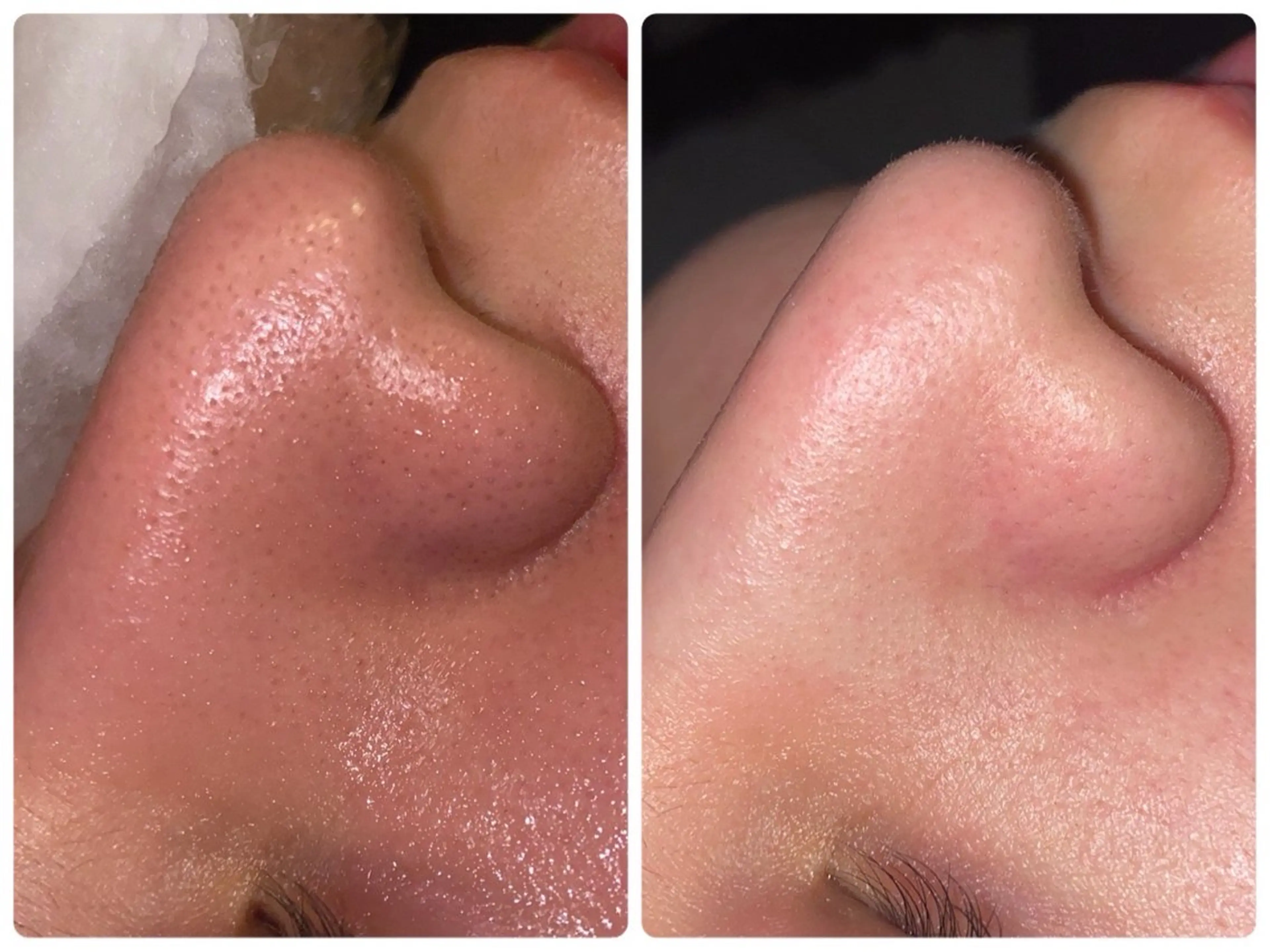 エステ 【BUB立川】 ななのエステ・リラクイメージ