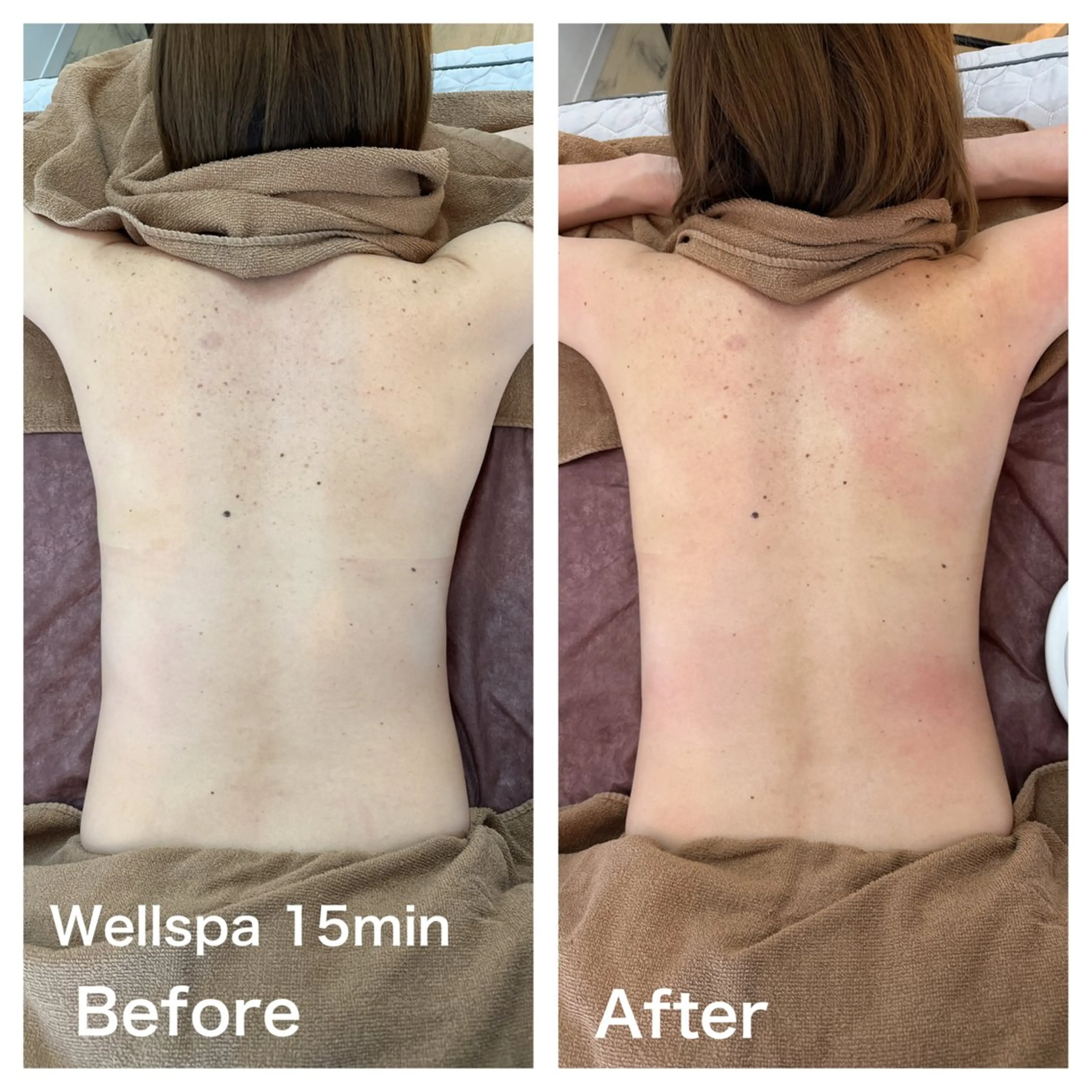 MetaBio Clinic所属・ERIKA ODAのエステ・リラクイメージ