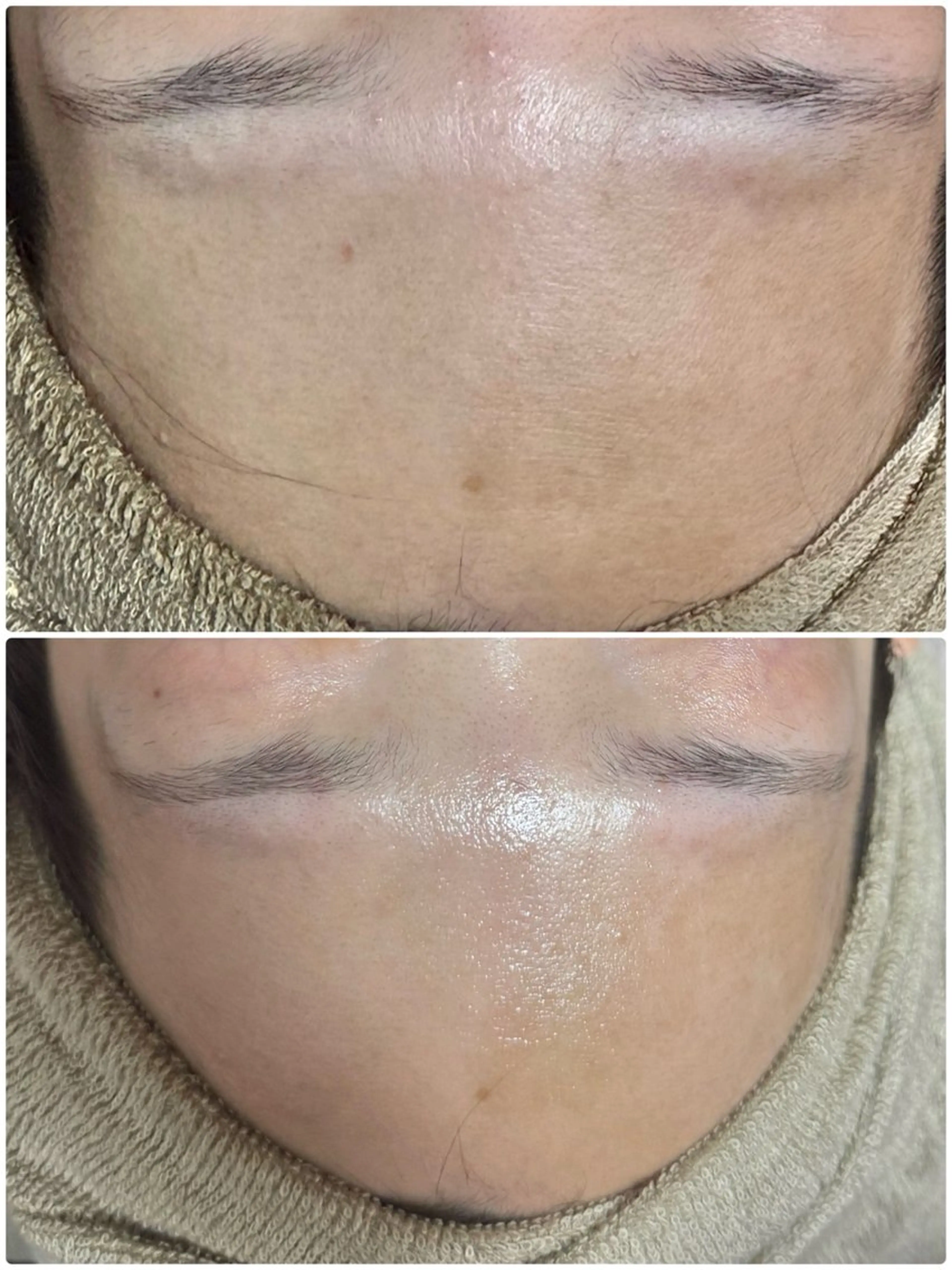 ☆大人気☆毛穴洗浄 エステブリランテのエステ・リラクイメージ