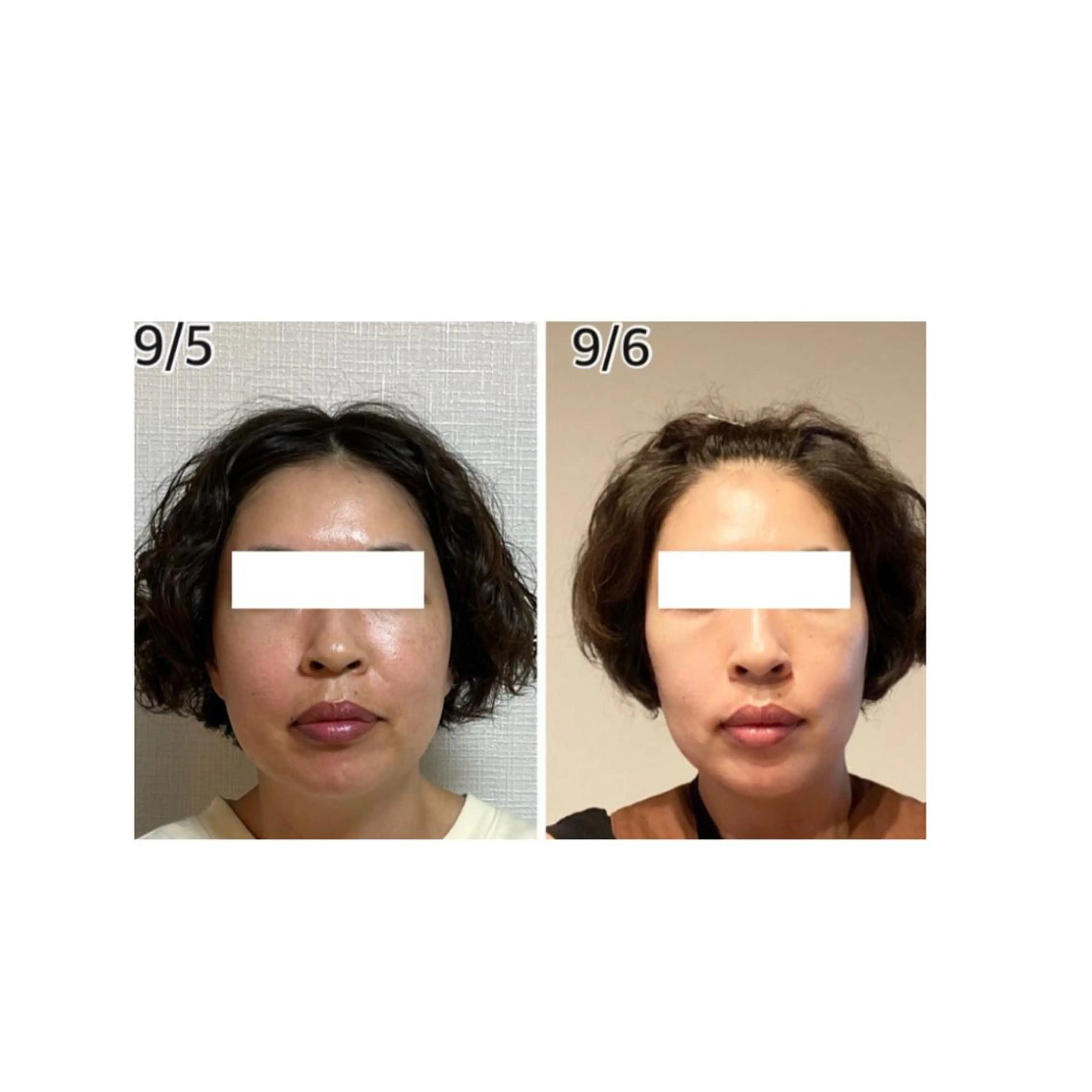 小顔・毛穴専門 ルシェルのエステ・リラクイメージ