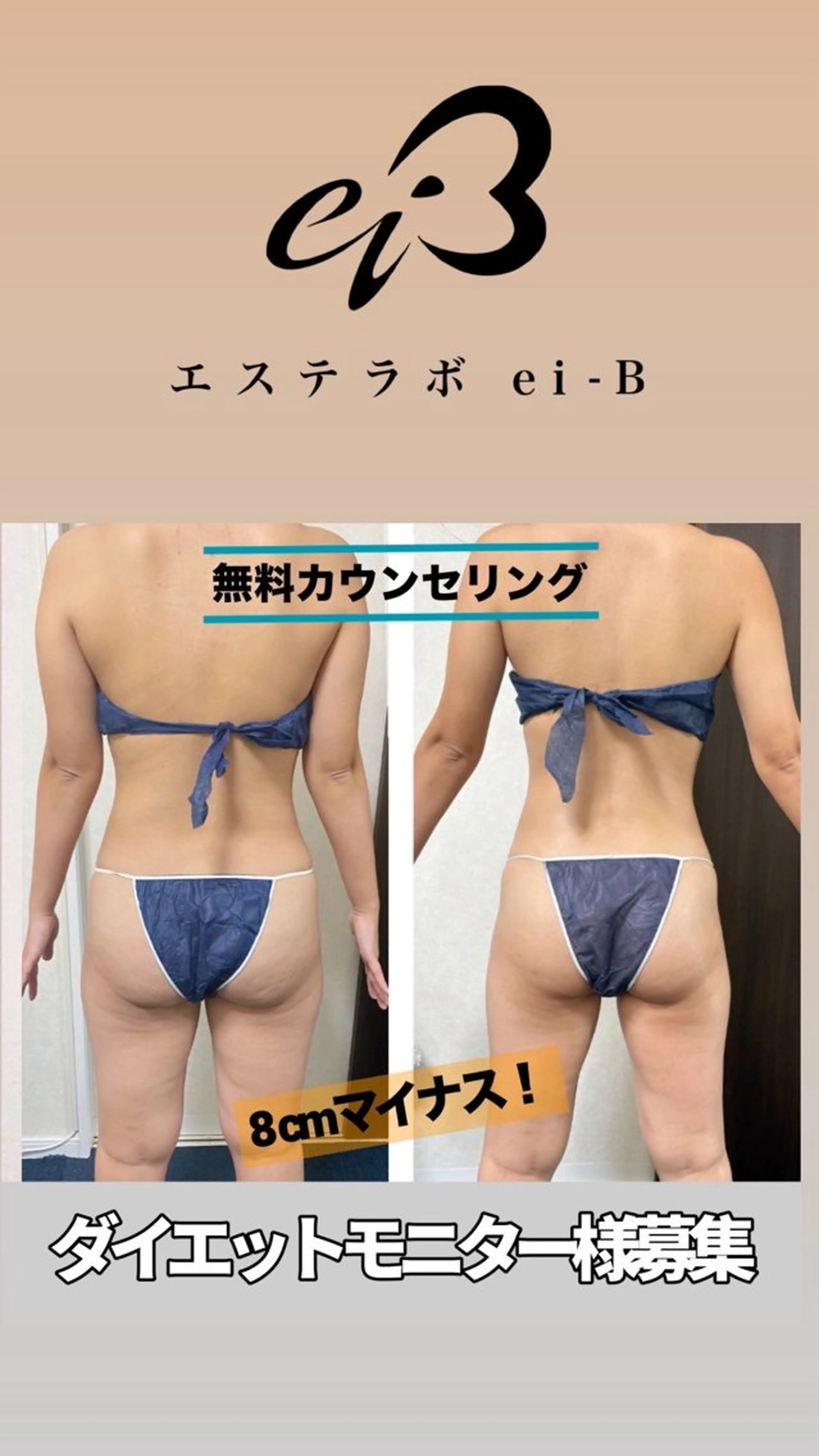 女性専用　ダイエットエステ体験の写真