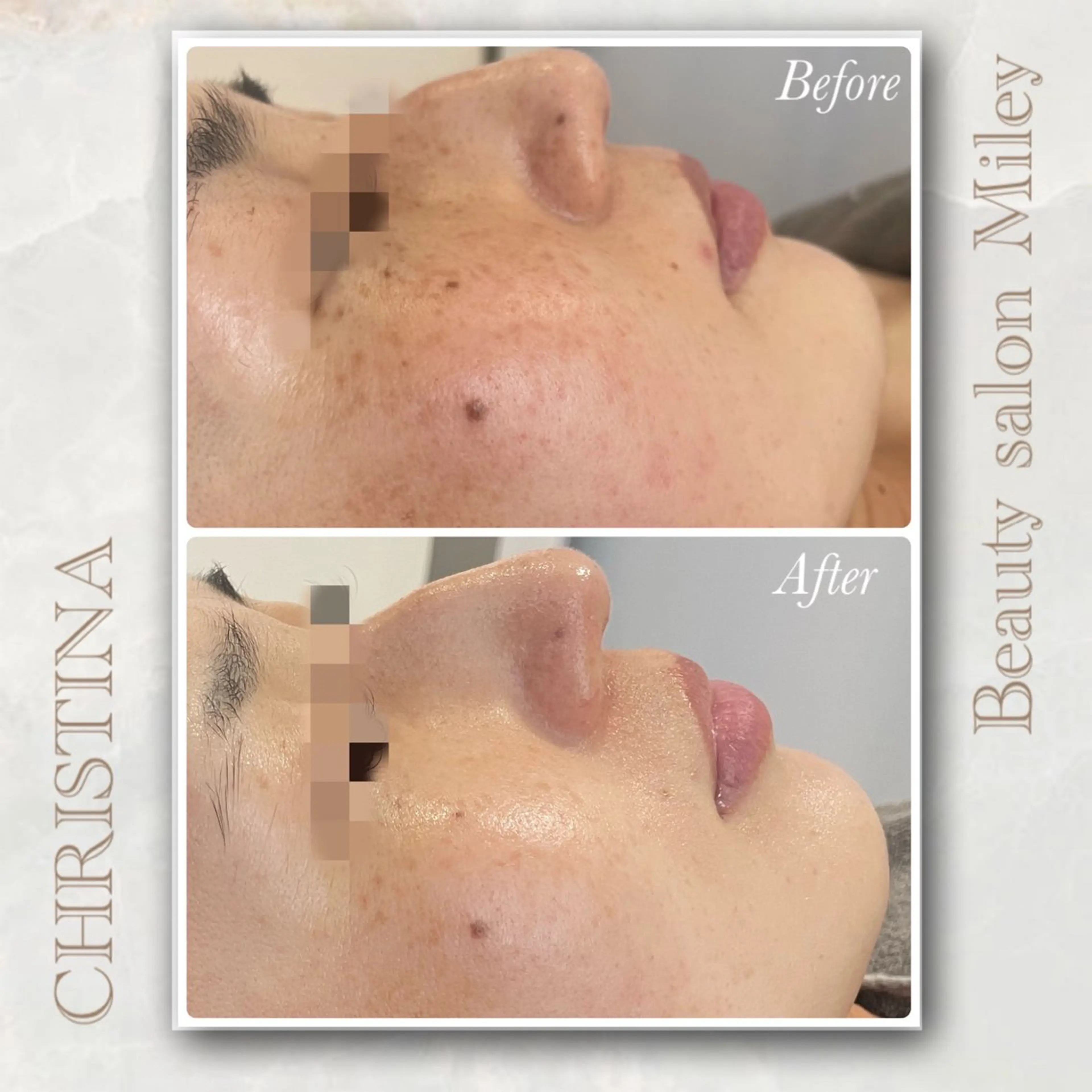 Miley/肌質改善 Megumiのエステ・リラクイメージ