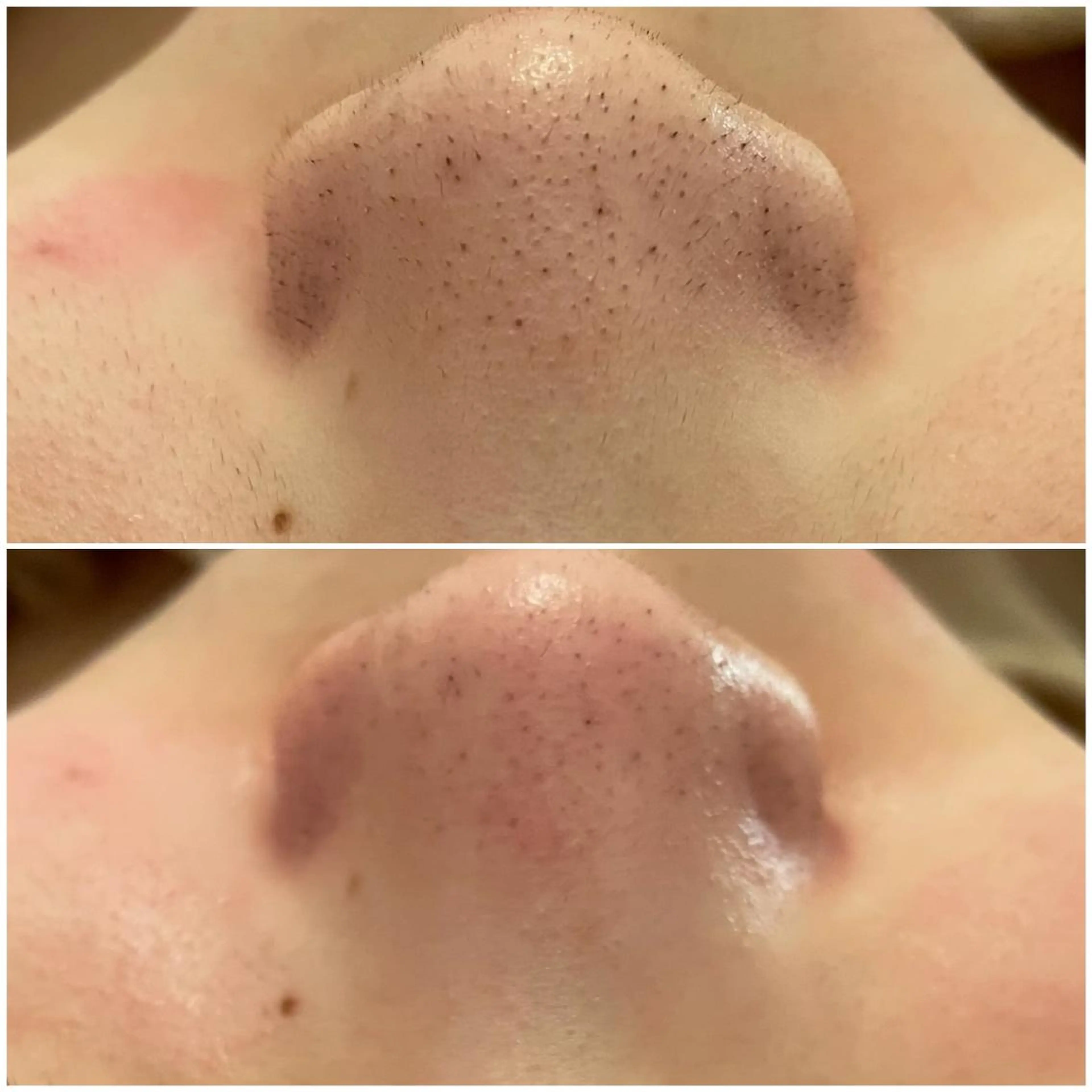 エステ ララ/ハーブ メゾンリュバンのエステ・リラクイメージ