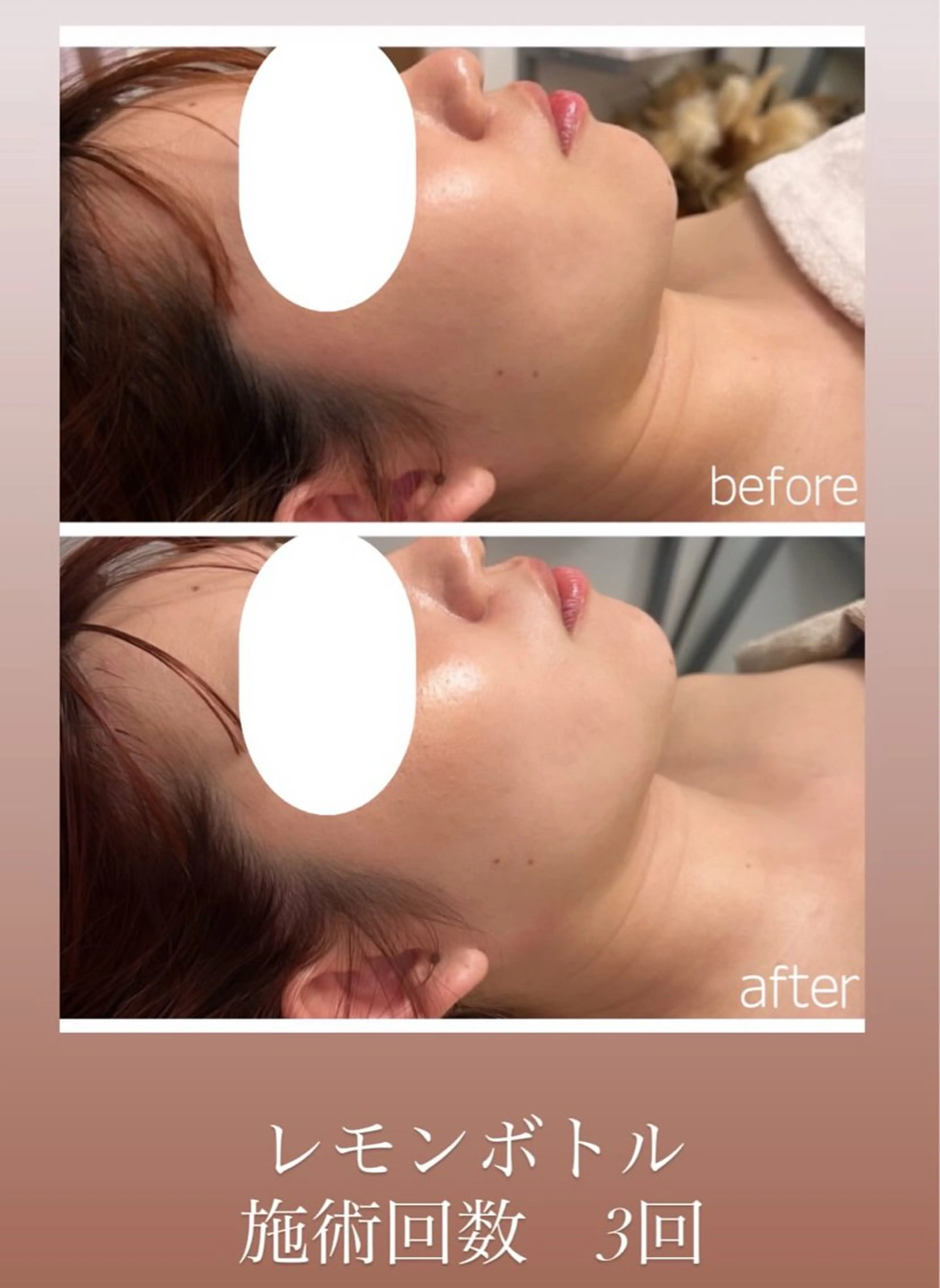 Raviy 【痩身・韓国肌管理】のエステ・リラクイメージ