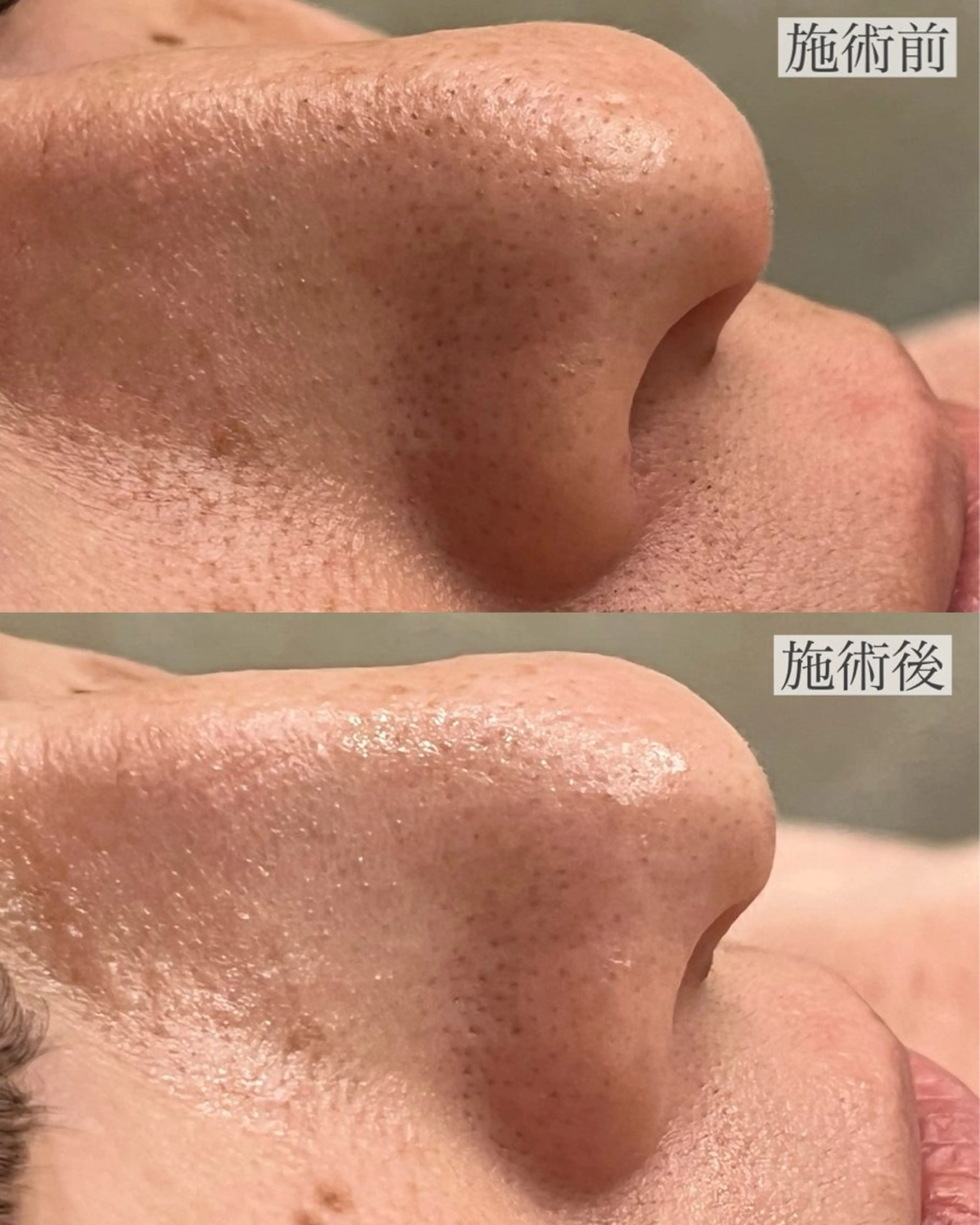 emiluca西目/ 脱毛/細胞美容のエステ・リラクイメージ