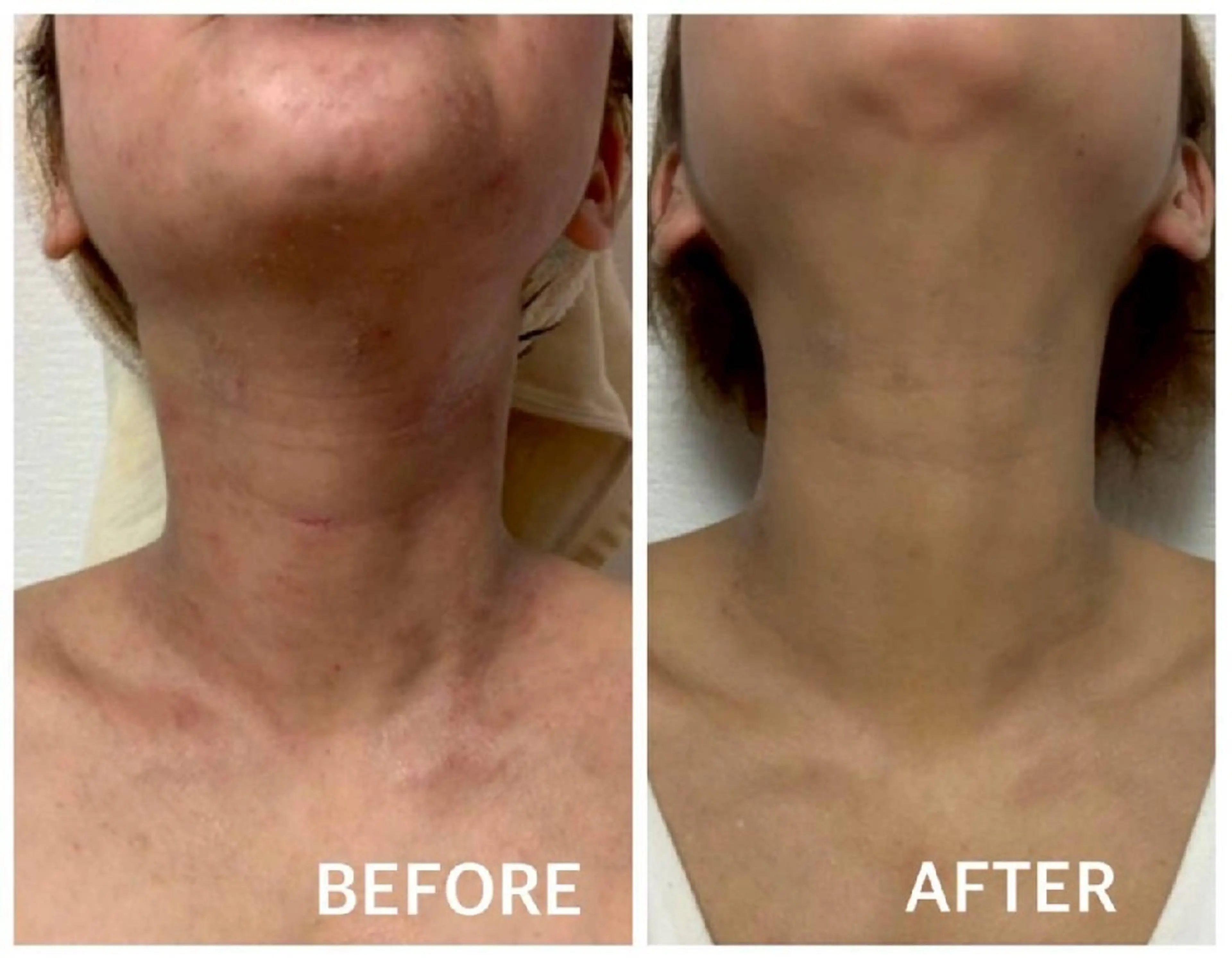 夜限定SARON 💎YISM💎のエステ・リラクイメージ