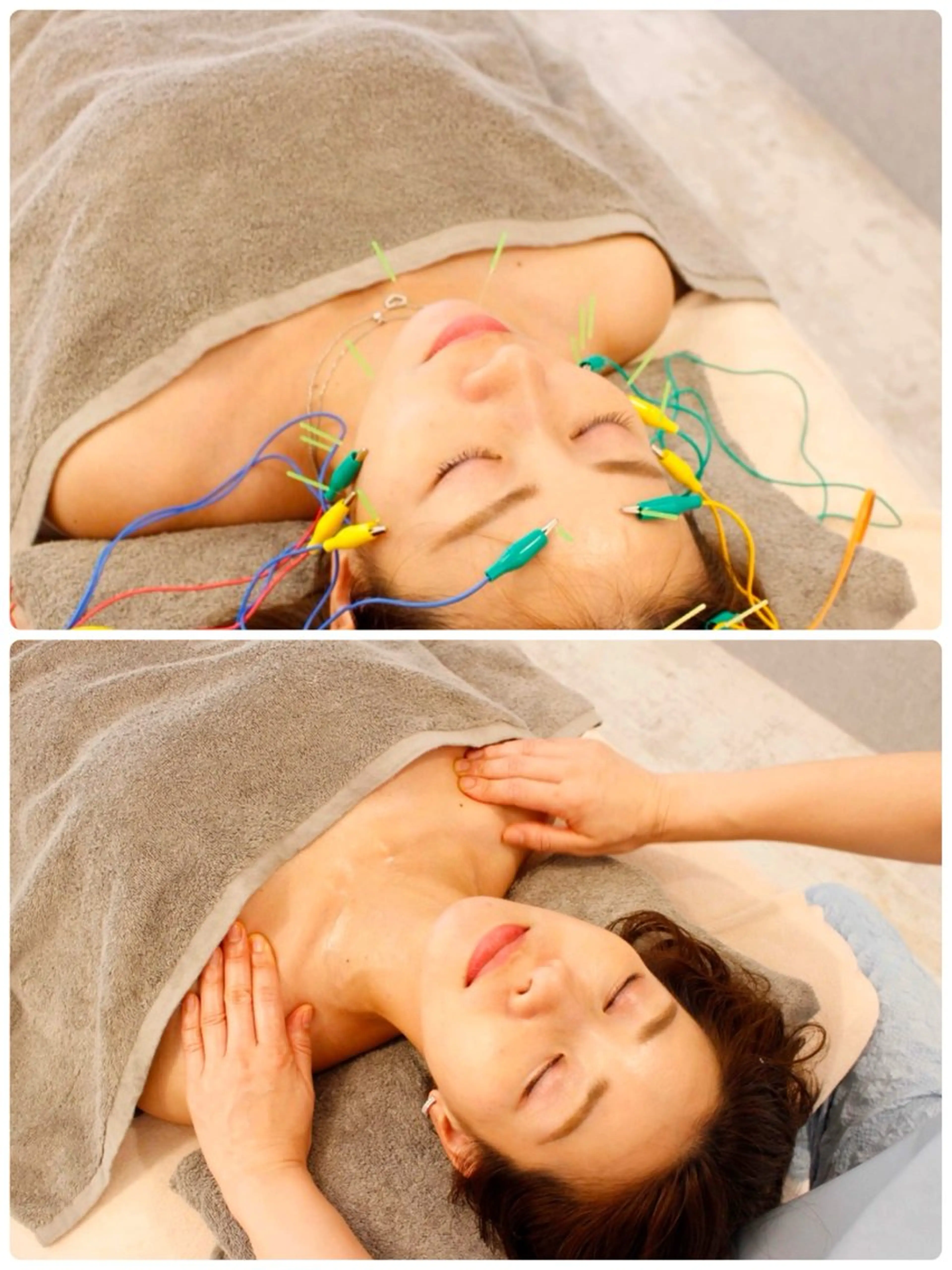 【電気美容鍼+体質別🌸オイル】疲れ顔、むくみ、疲労、顔肩デコルテオイル+頭蓋骨調整✳︎学生-1000円の写真