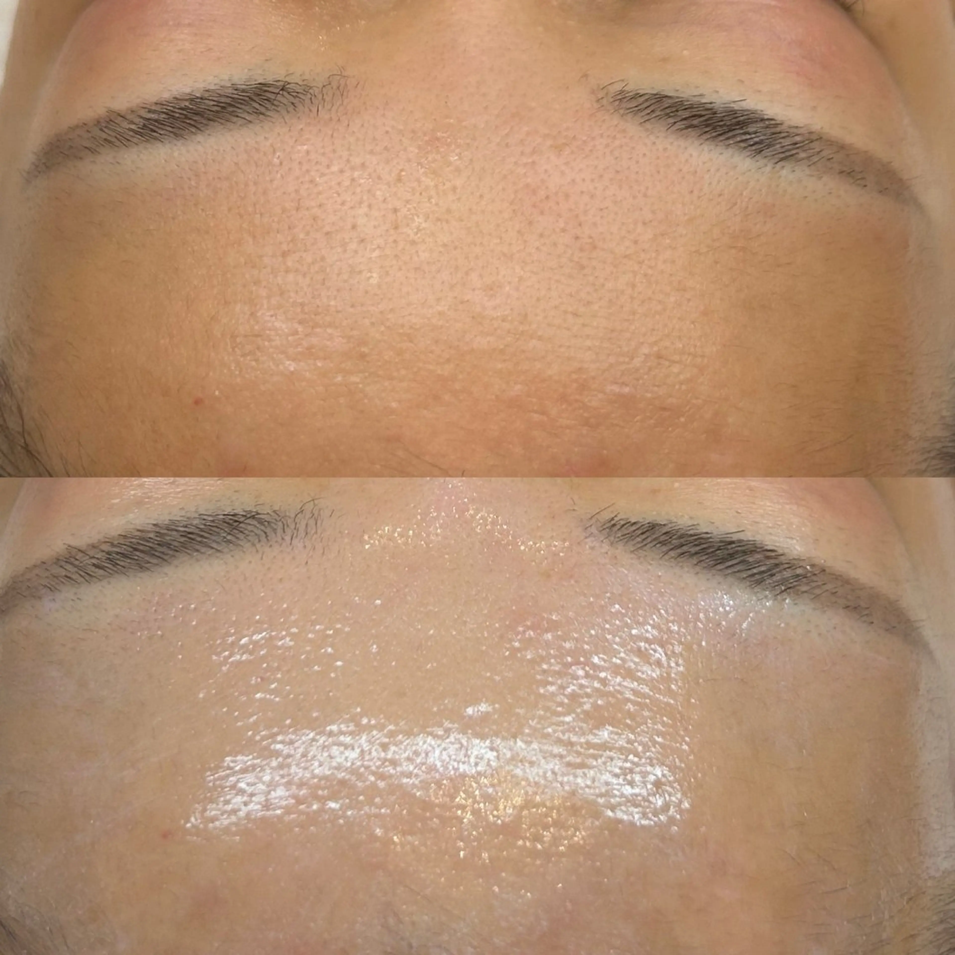 エステ 韓国🇰🇷価格 サロン_Nbibiの眉毛・アイブロウイメージ