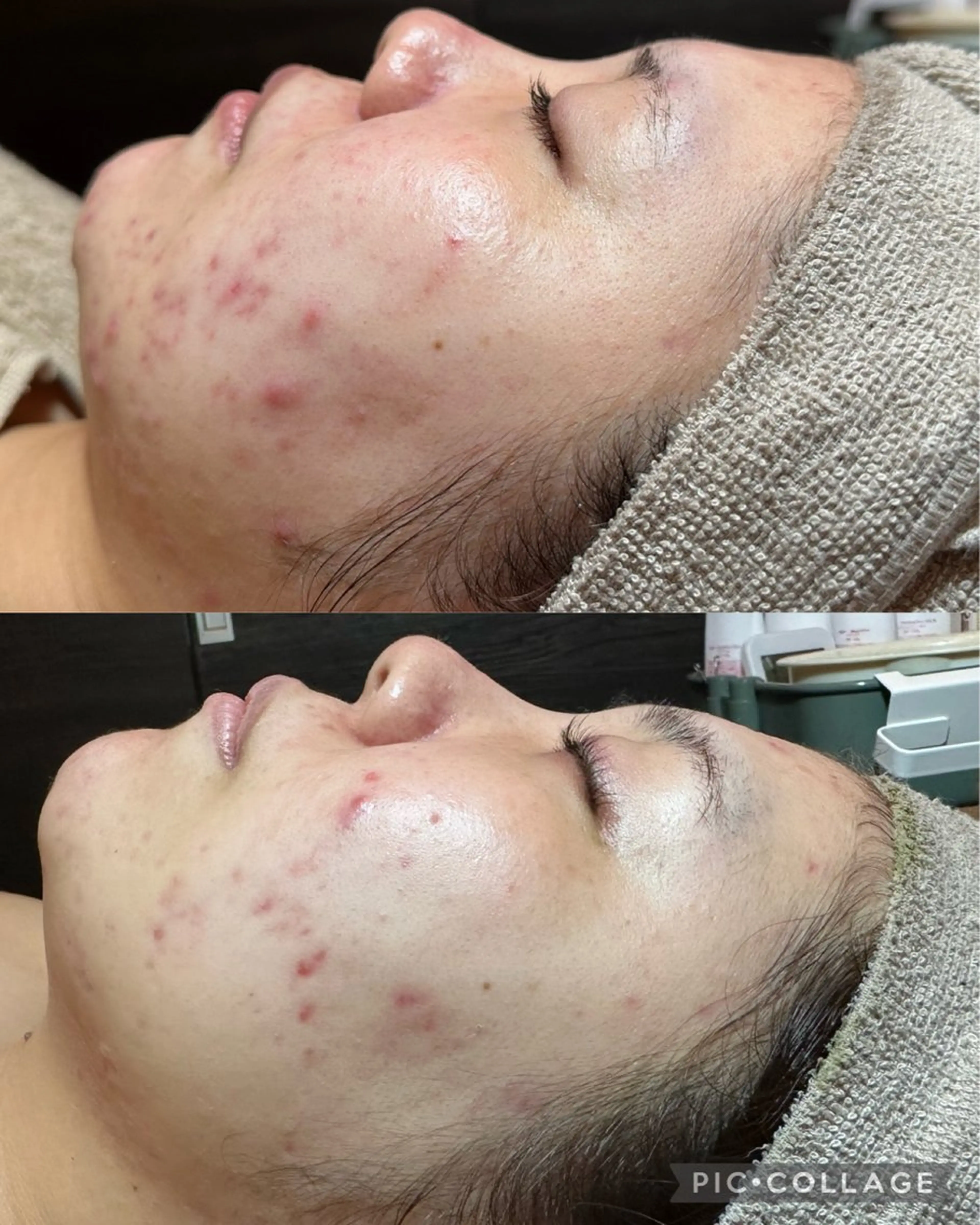 エステ Feel♡ JYURIAのネイルデザイン