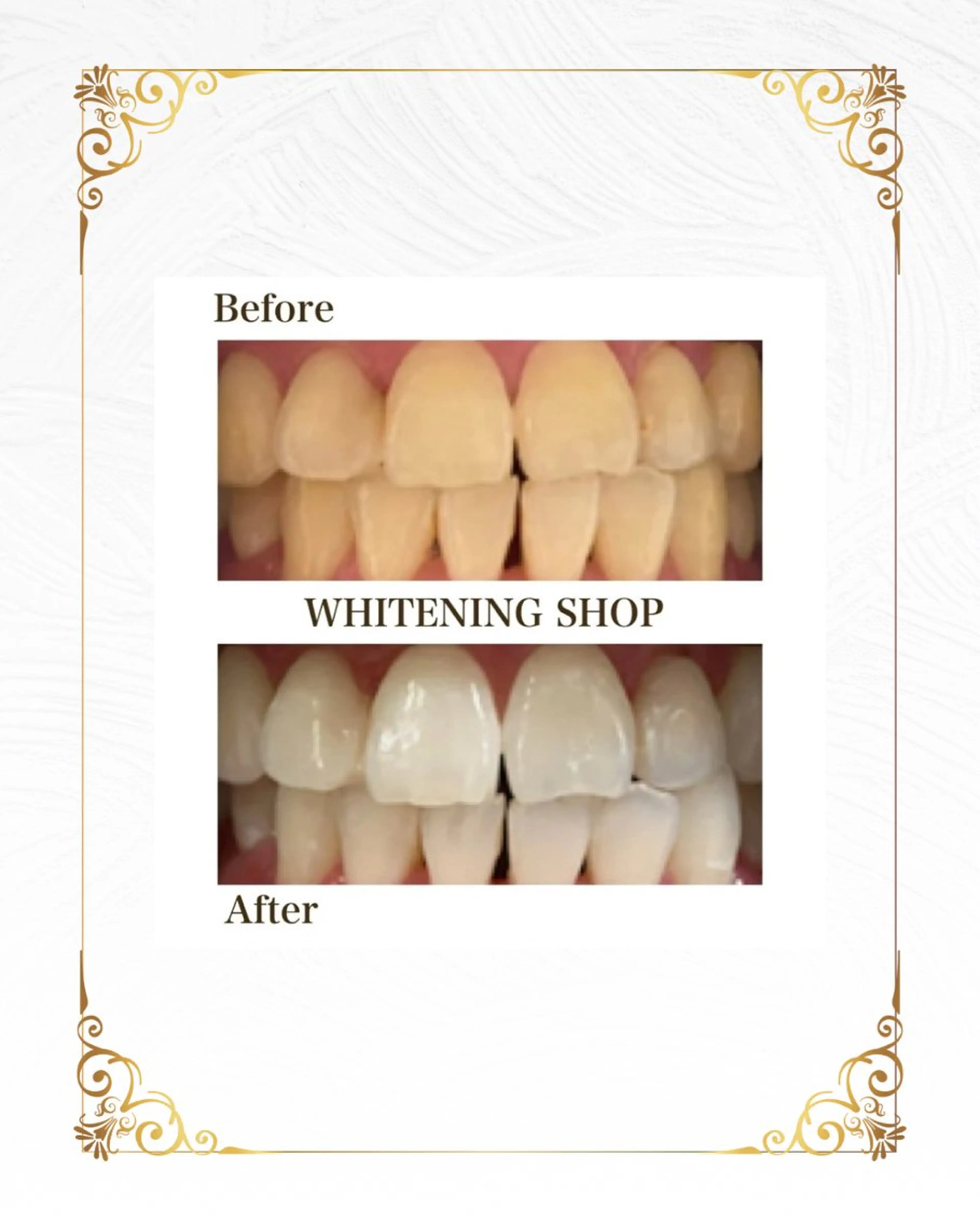 ホワイトニング ショップ葵区静岡駅店のその他イメージ