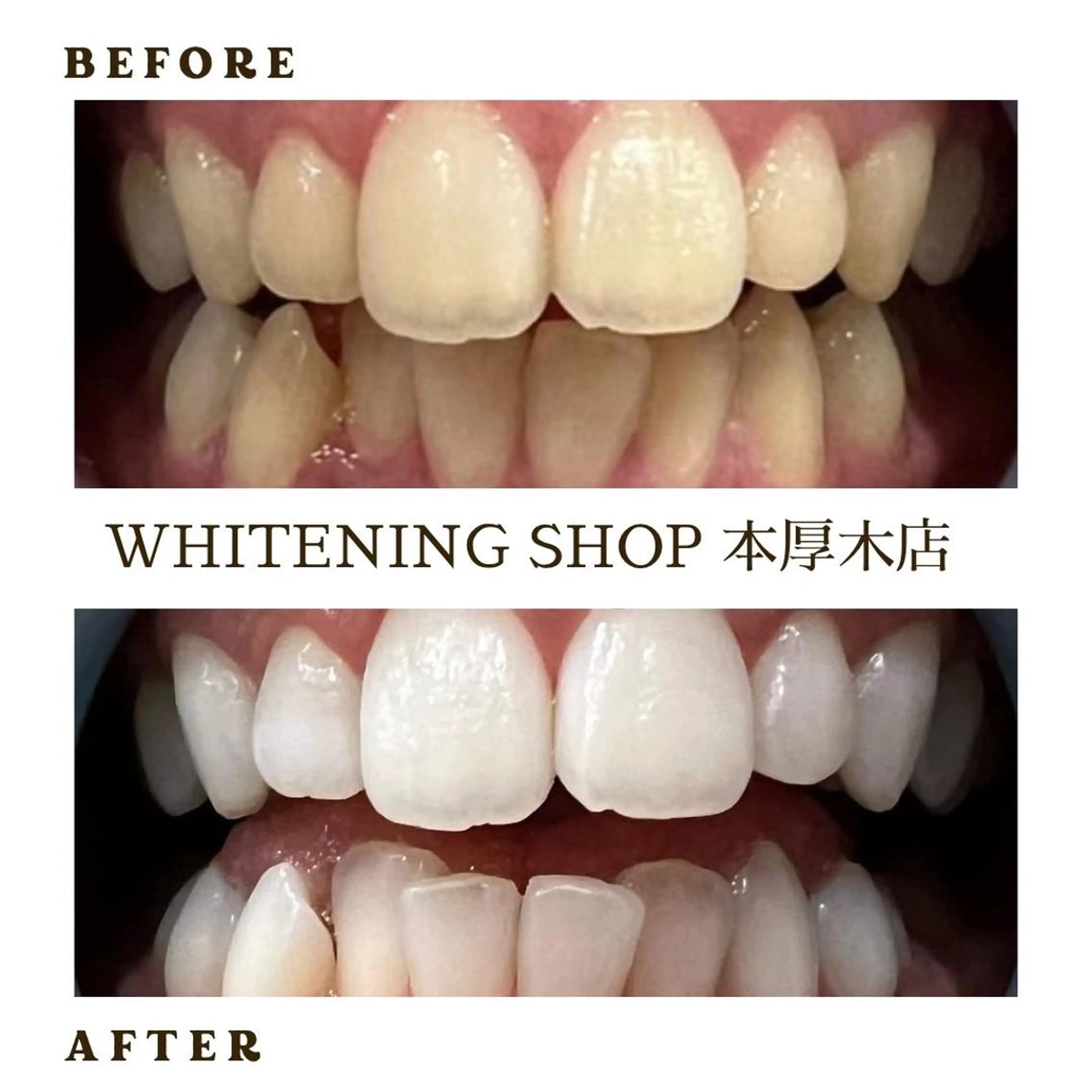 メンズ その他 ホワイトニング ショップ本厚木のその他イメージ