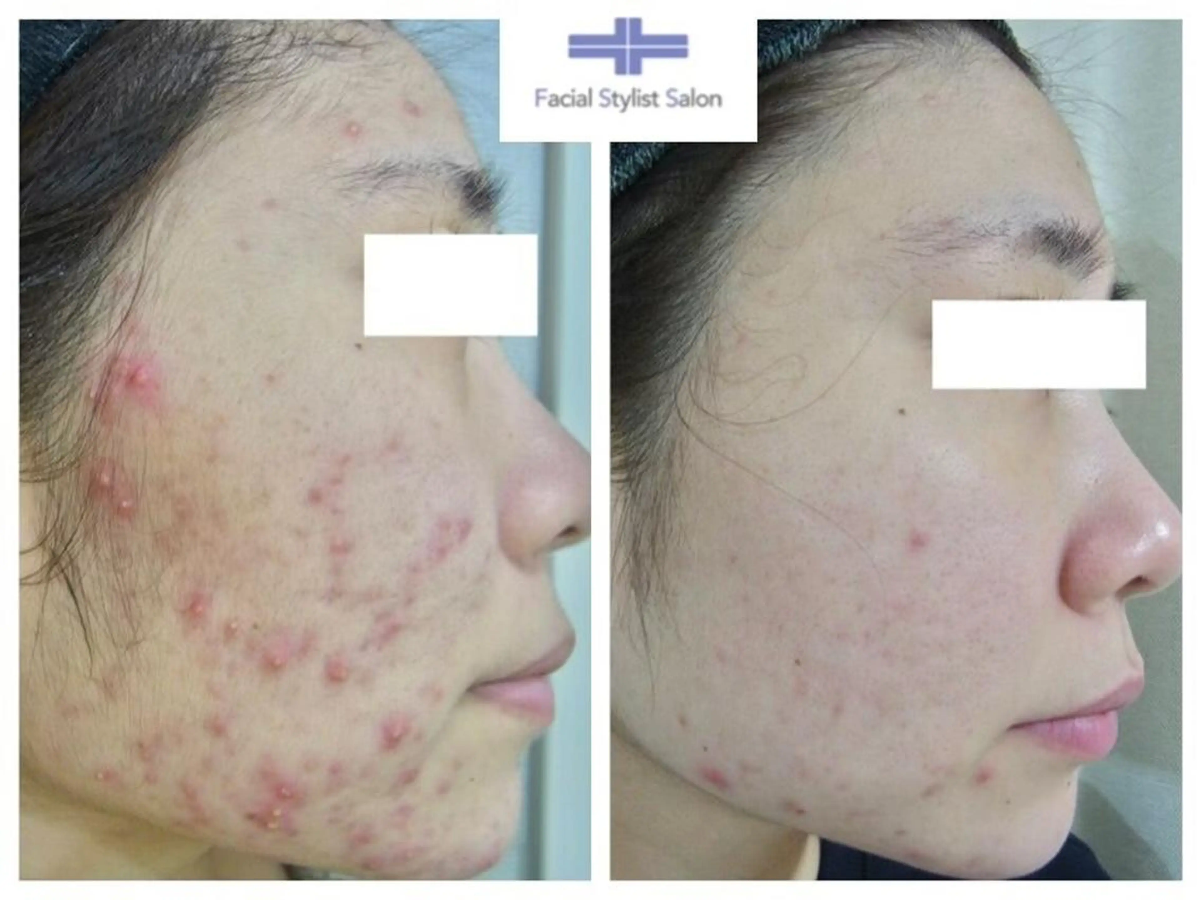 肌質改善専門サロン ／FSS渋谷店　松本のエステ・リラクイメージ